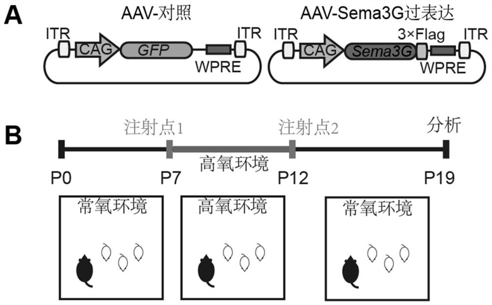 Medical application of recombinant protein Semaphorin3G in prevention and treatment of retinal diseases