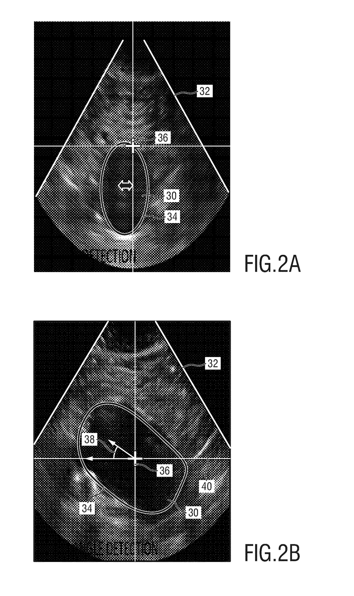 Ultrasound imaging apparatus and ultrasound imaging method for inspecting a volume of a subject