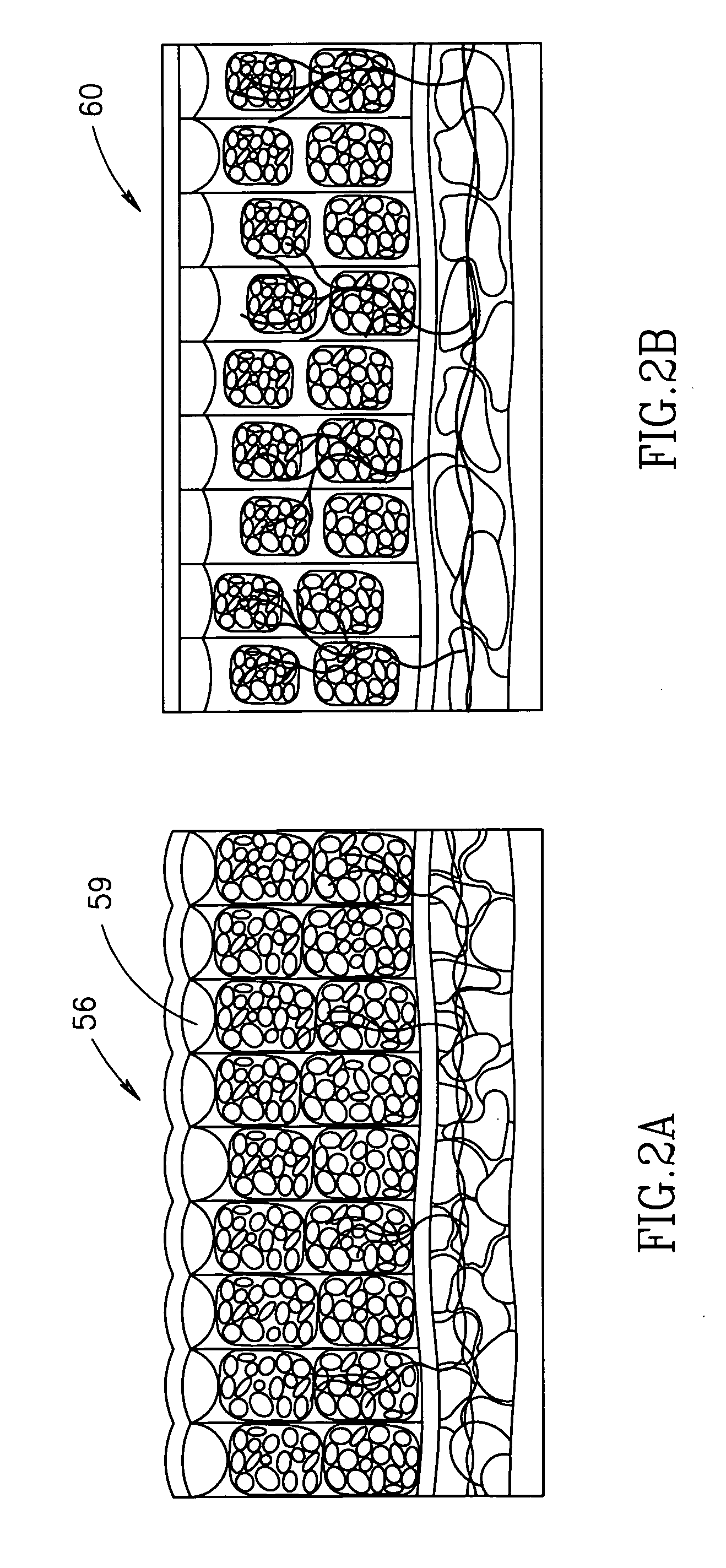 Method for reducing the appearance of skin cellulites using vacuum radiant heat and mechanical manipulation