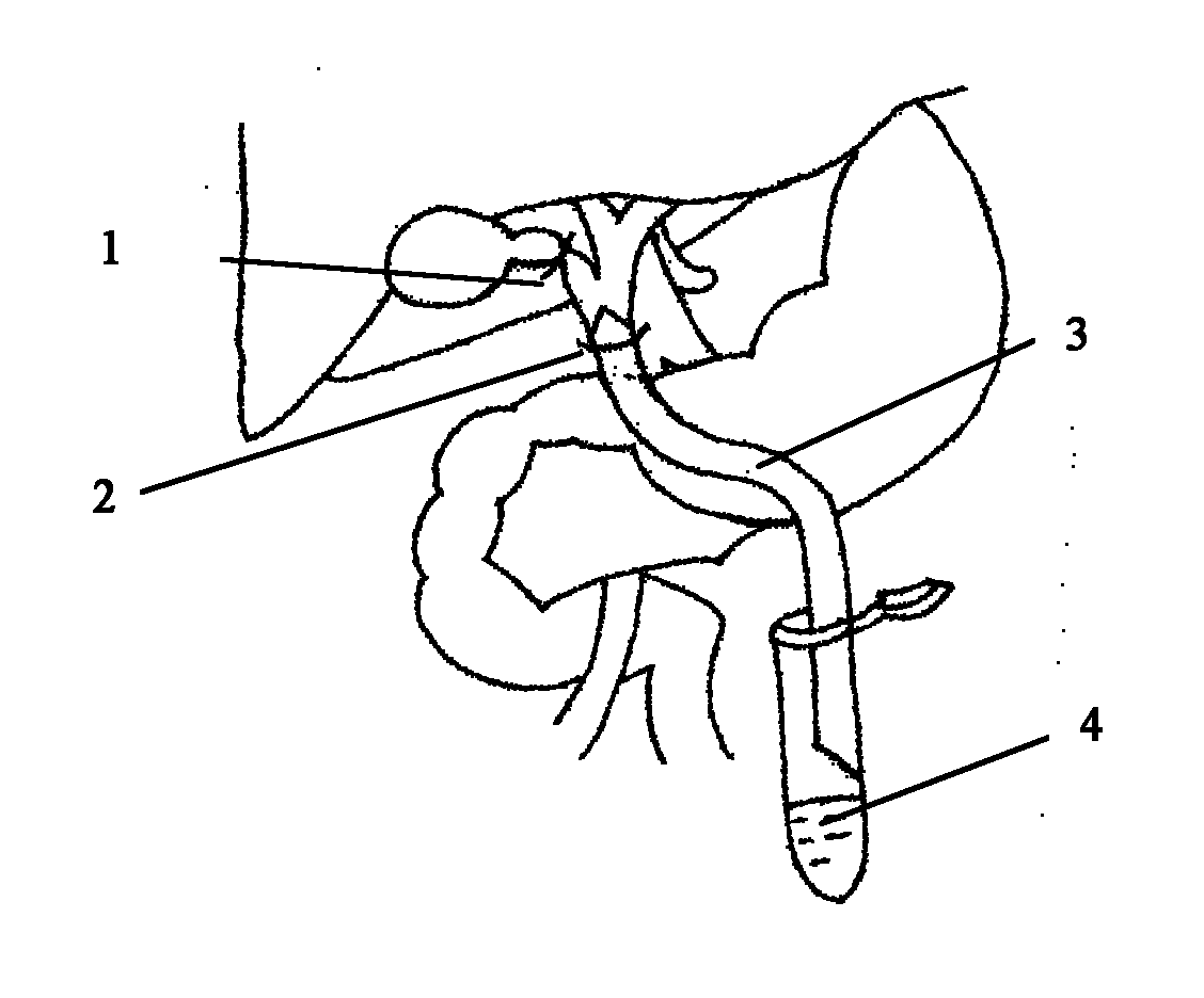 Biliary excretion experimental animal model and building method