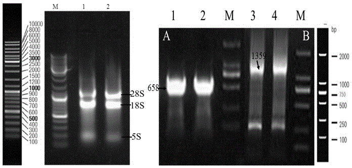 Recombinant gene of glutamate dehydrogenase, acquisition method of recombinant gene, and application of glutamate dehydrogenase recombinant enzyme