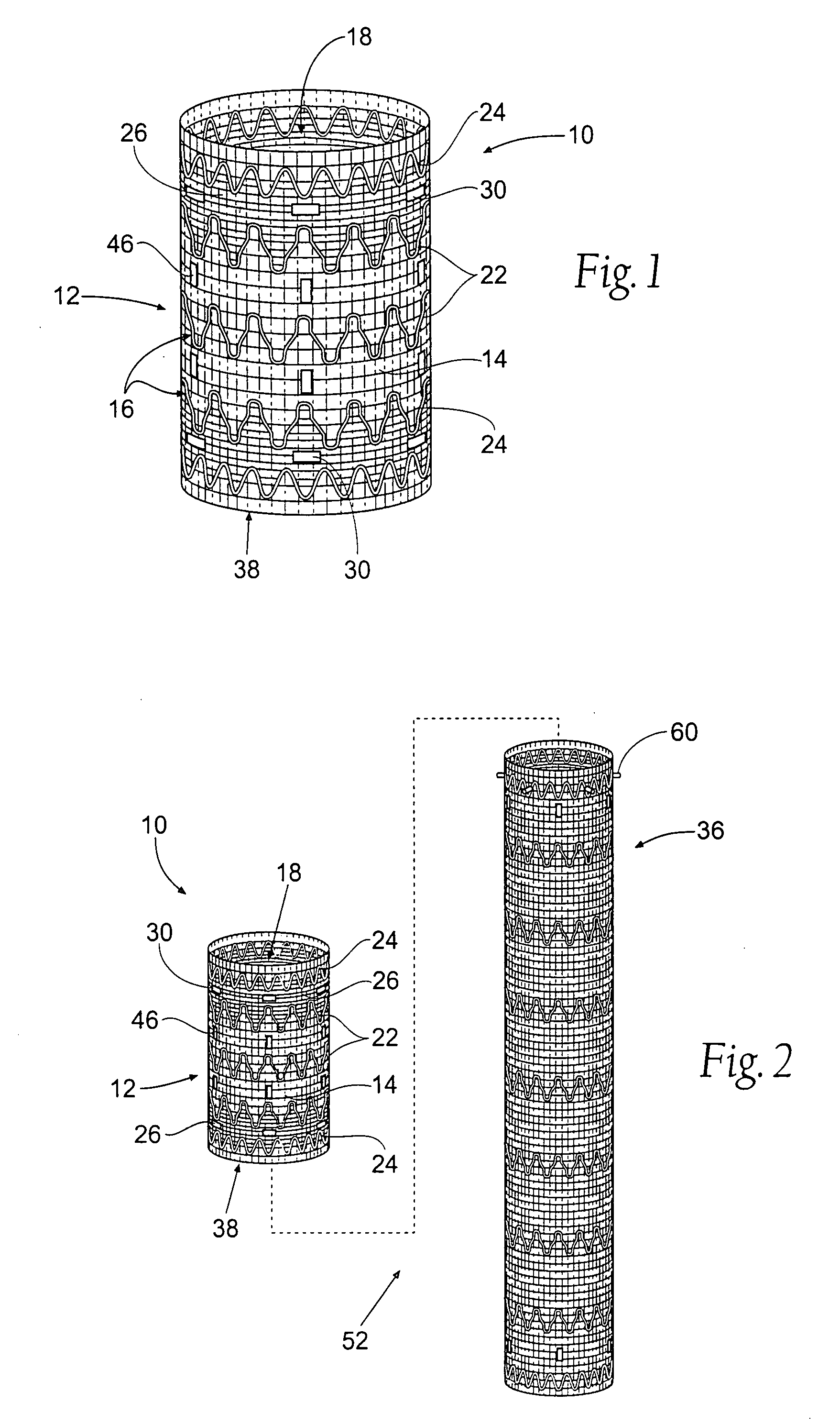 Prosthesis systems and methods