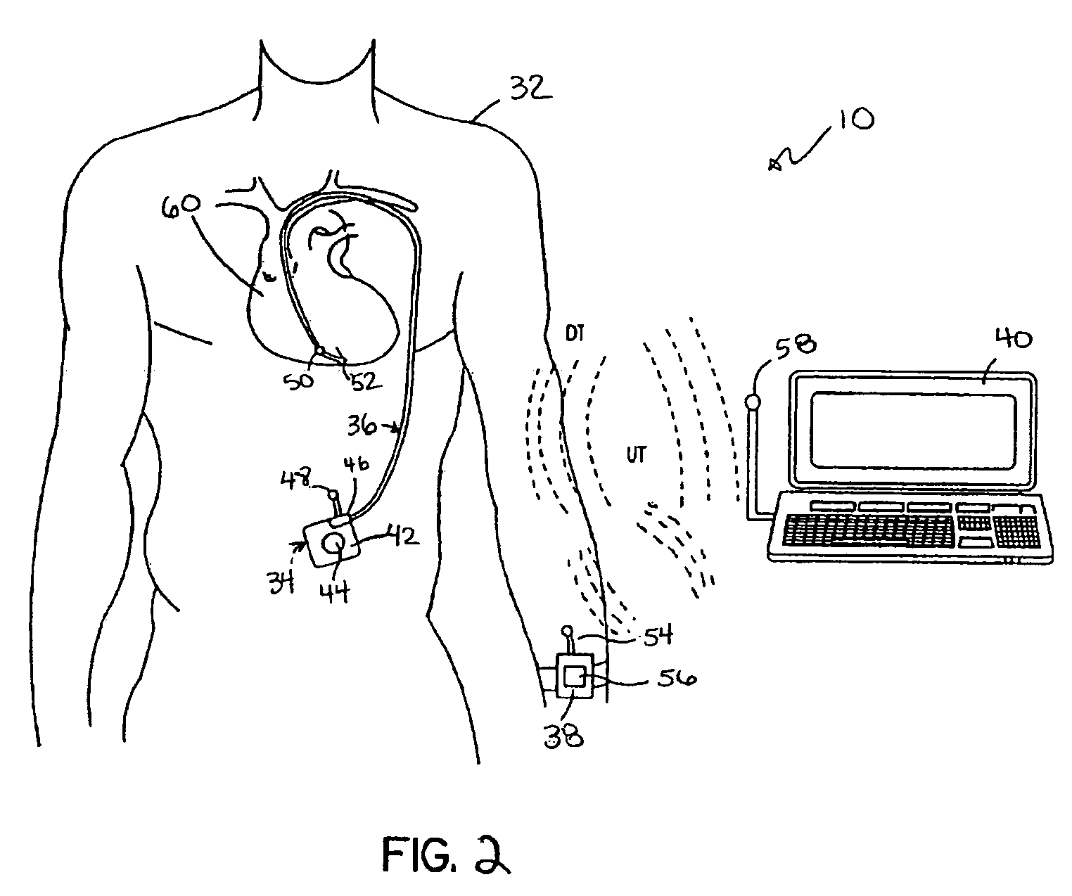 System and method for monitoring myocardial performance using sensed ventricular pressures