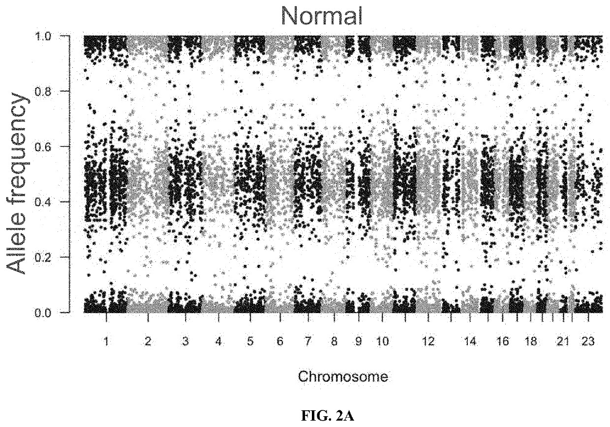 Method of improving prediction of response for cancer patients treated with immunotherapy