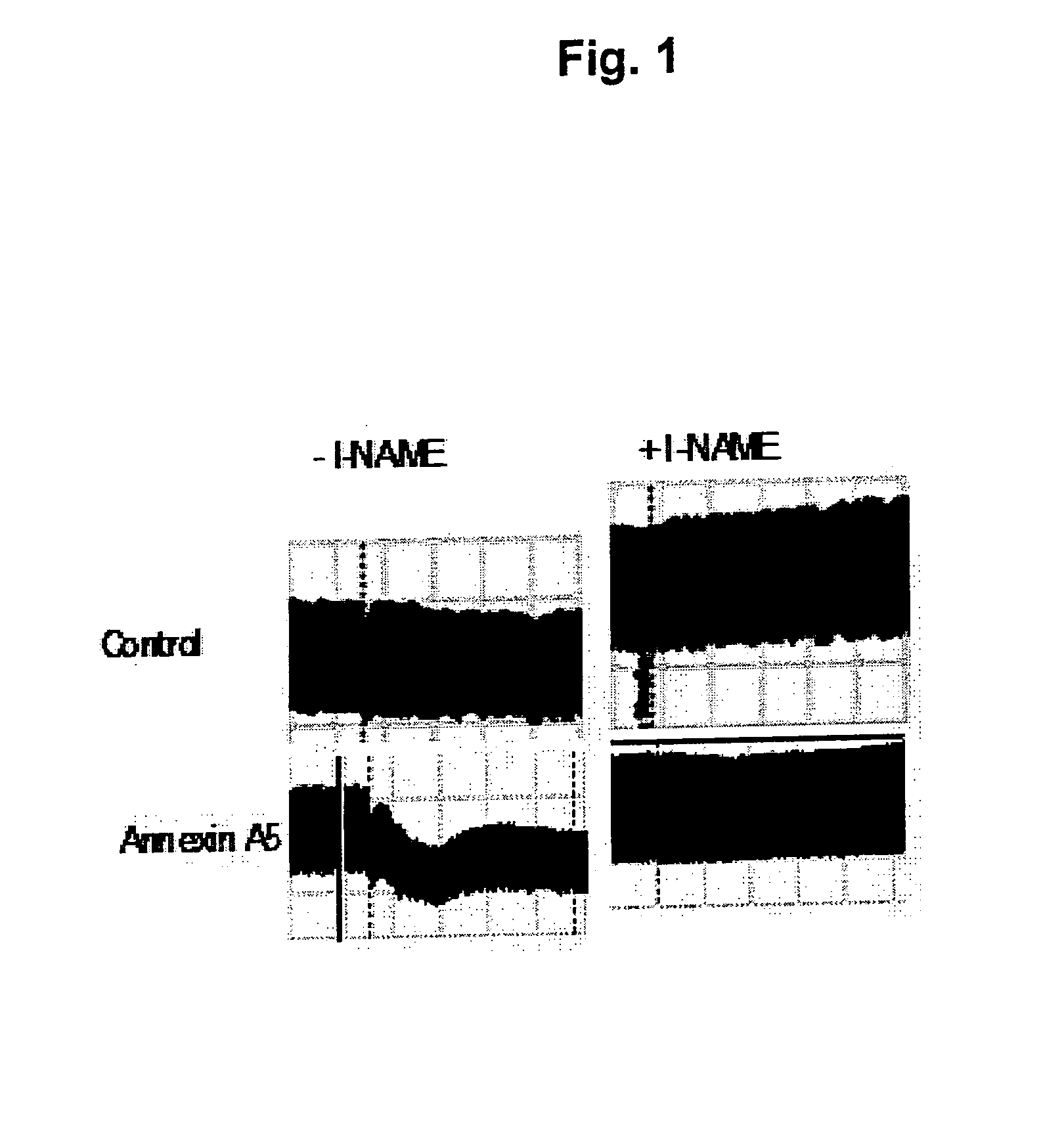 Compounds and Methods for the Treatment of Vascular Disease