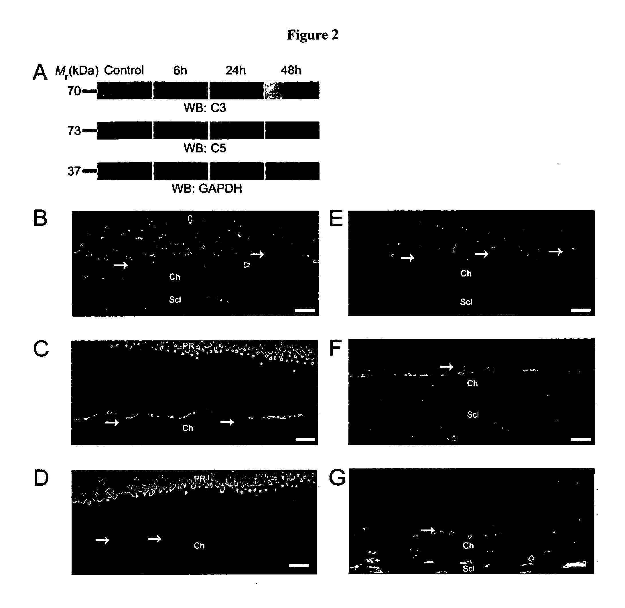 Compositions and methods for inhibiting drusen complement components C3a and C5a for the treatment of age-related macular degeneration