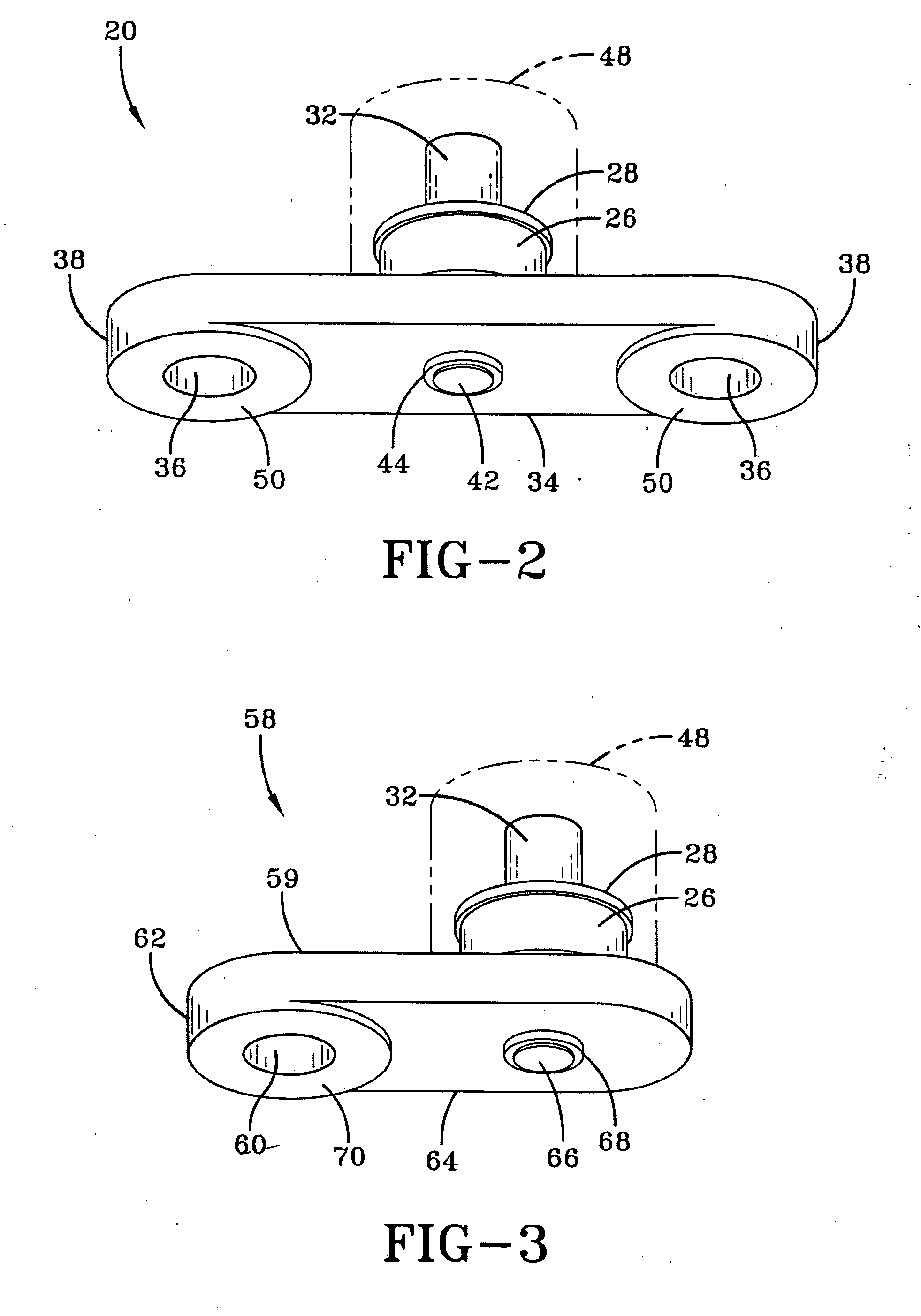 Magnetostrictive stress wave sensor