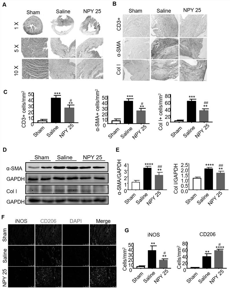 New applications of neuropeptide y