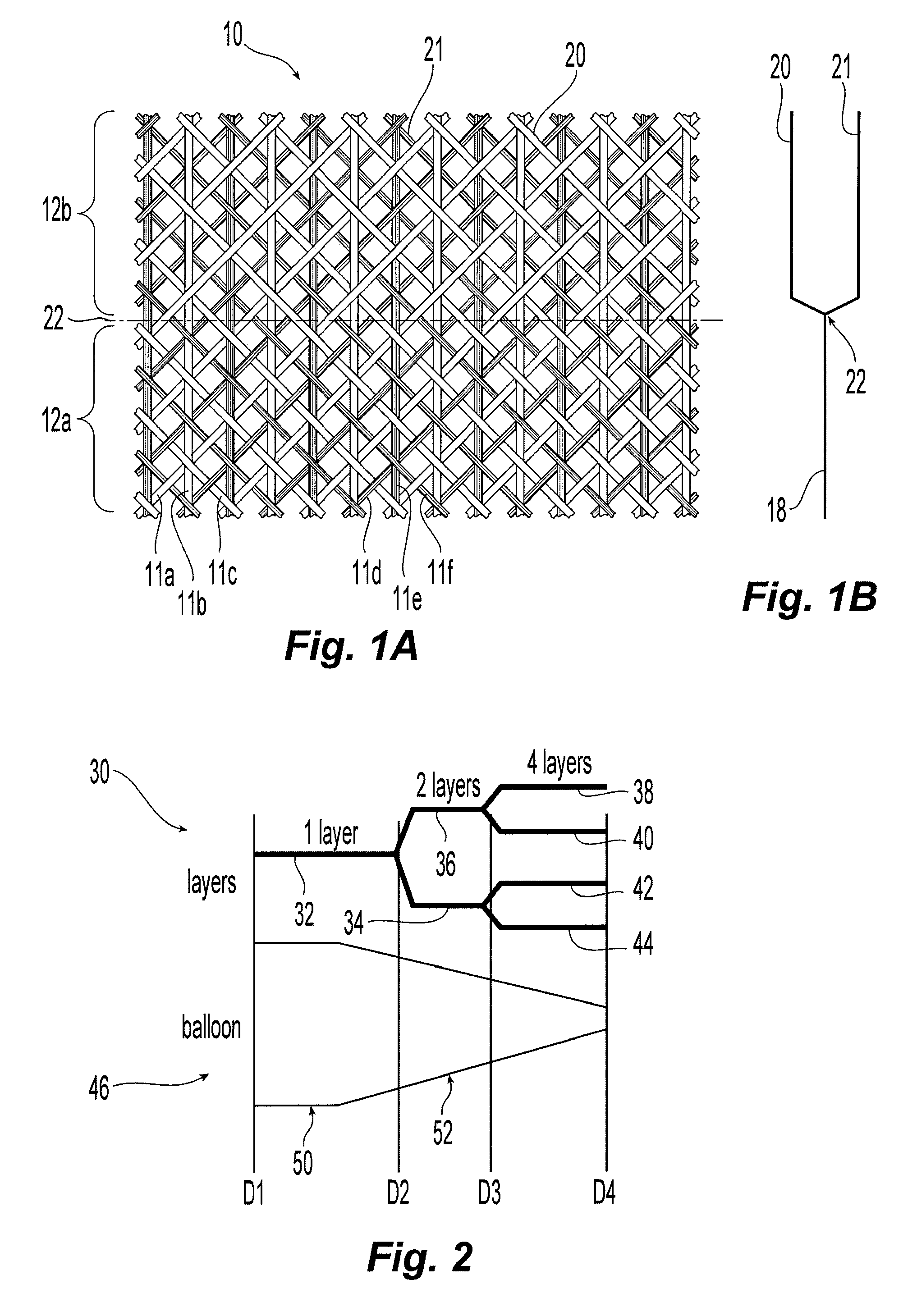 Balloon with dividing fabric layers and method for braiding over three-dimensional forms