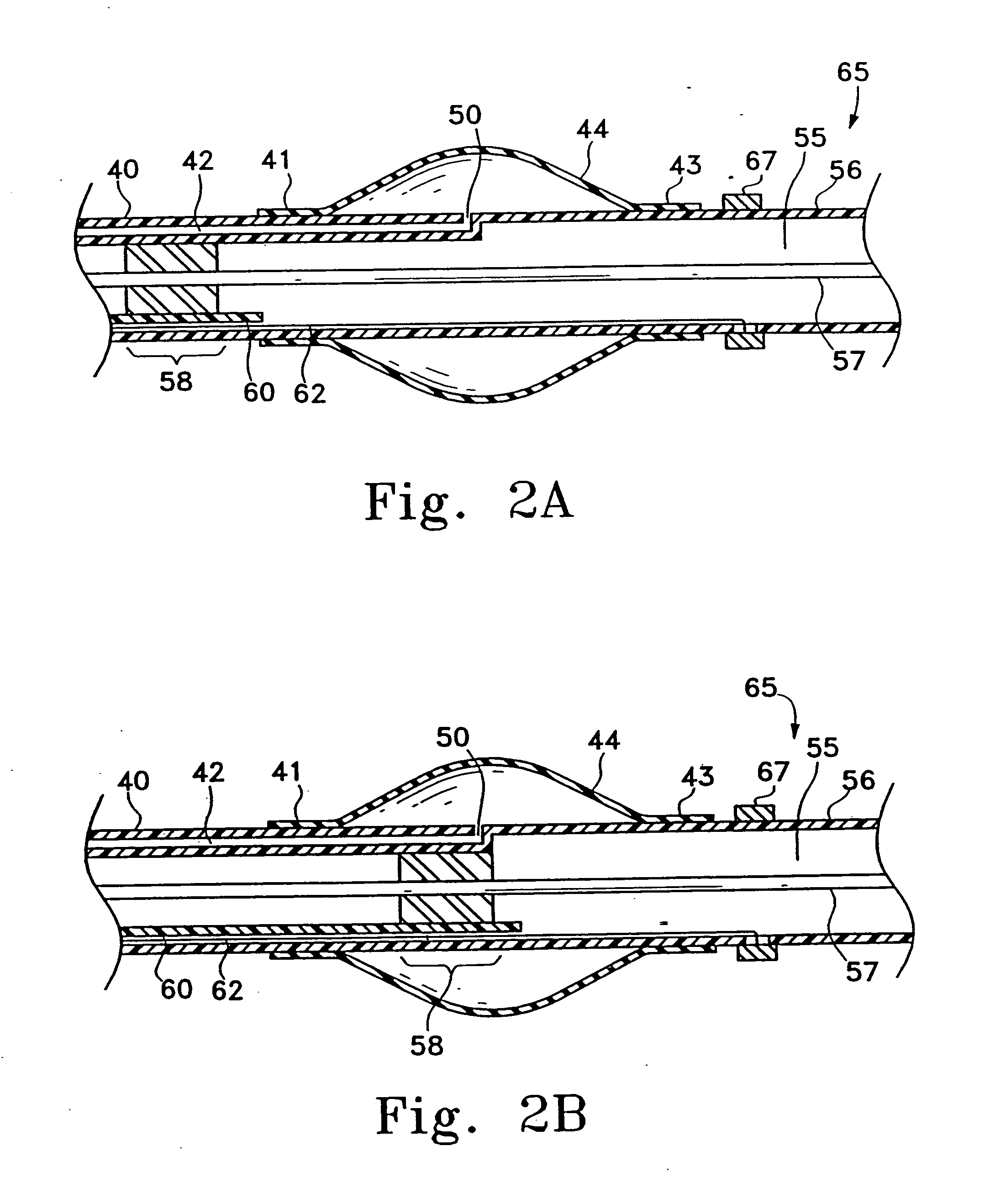 Manipulatable delivery catheter for occlusive devices (II)