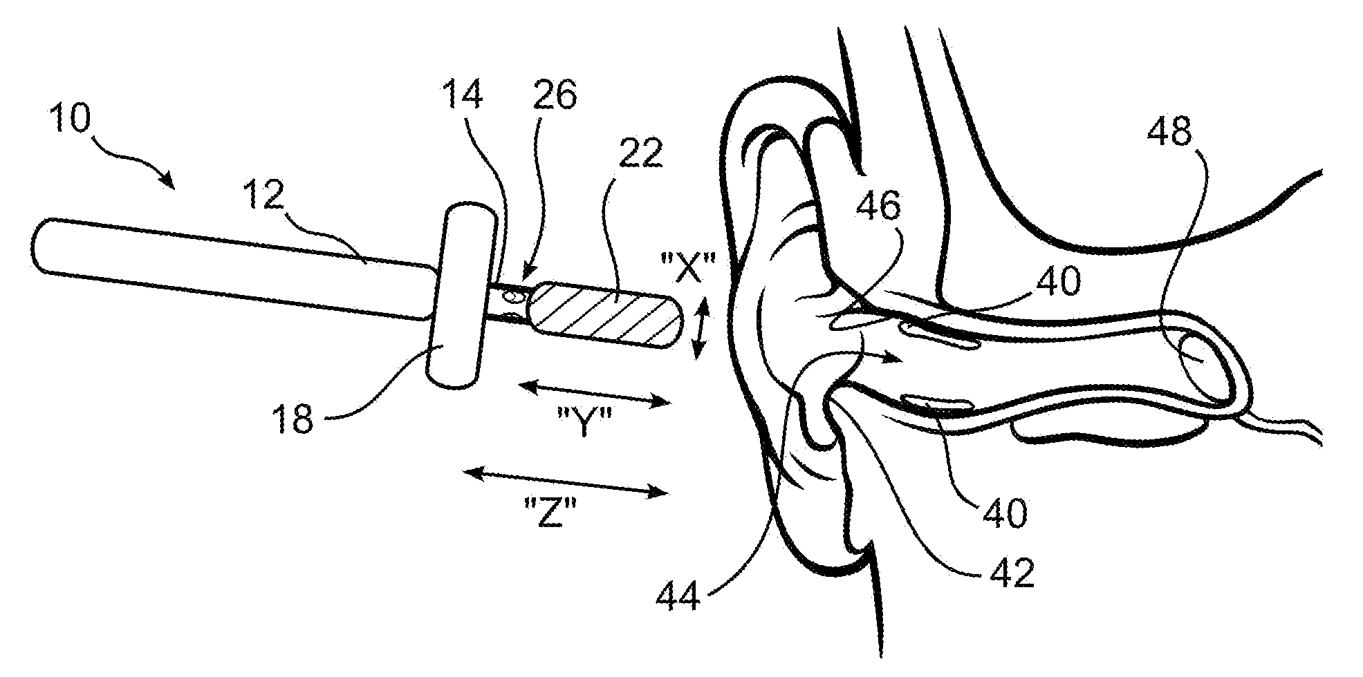 Ear cleaning system and method