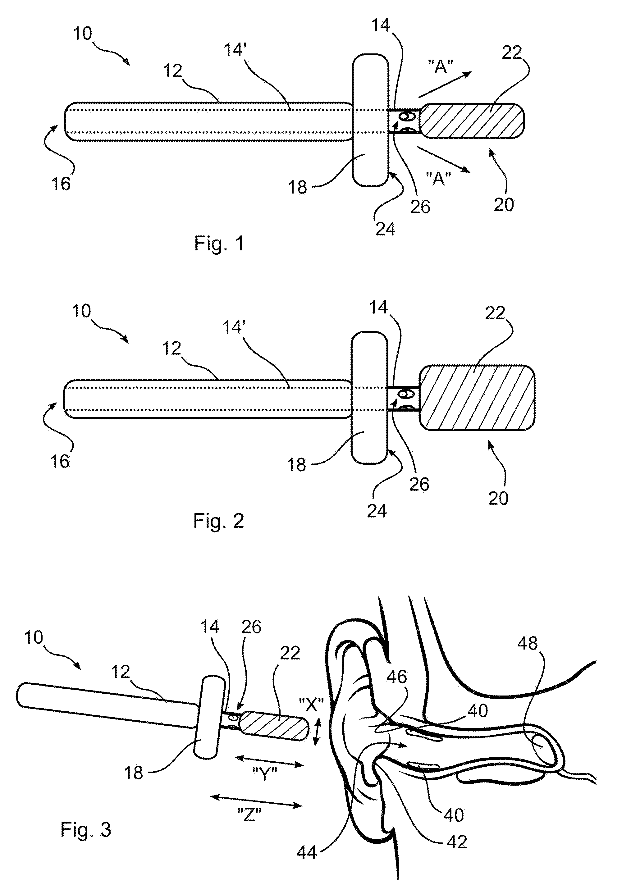 Ear cleaning system and method