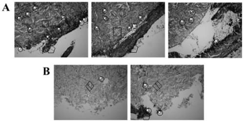 Injectable polymer hydrogel based on acylhydrazone bond, its preparation method and polymer hydrogel injection