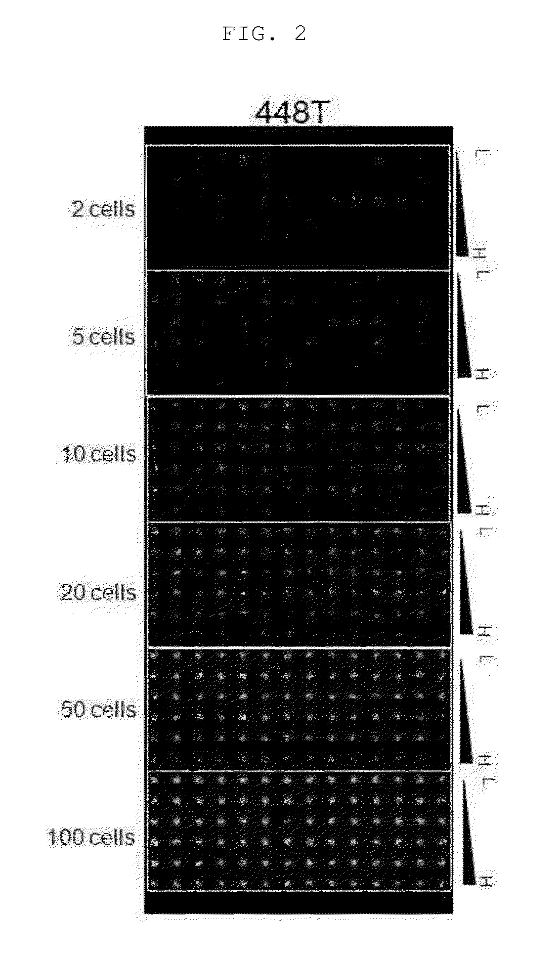Method for screening patient-specific Anti-cancer agent using limiting dilution assay