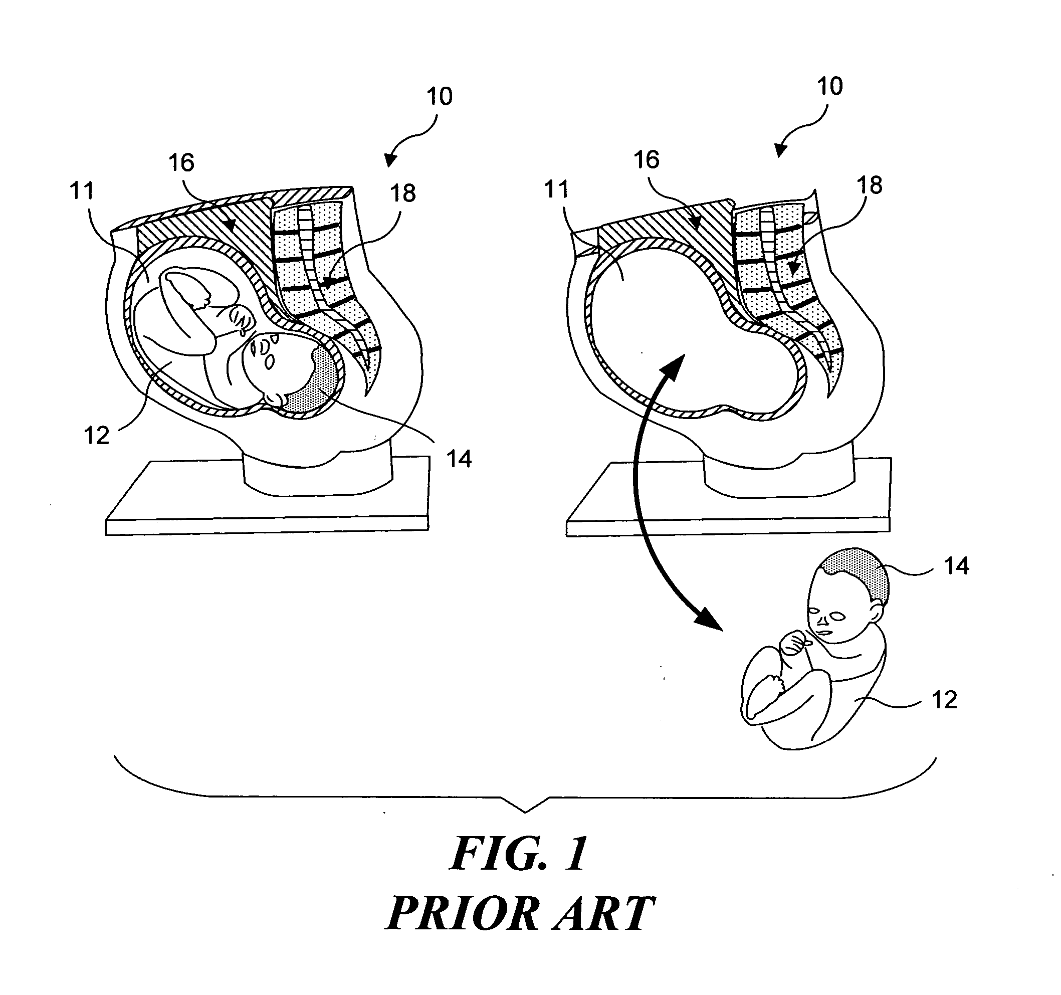 Simulated anatomical structures incorporating an embedded image layer
