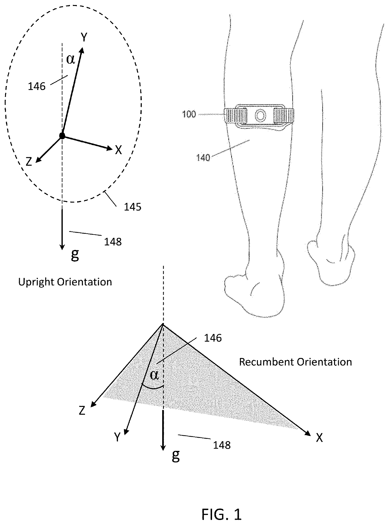 Apparatus and method for automated control of a transcutaneous electrical nerve stimulation (TENS) device based on tens user's activity type, level and duration