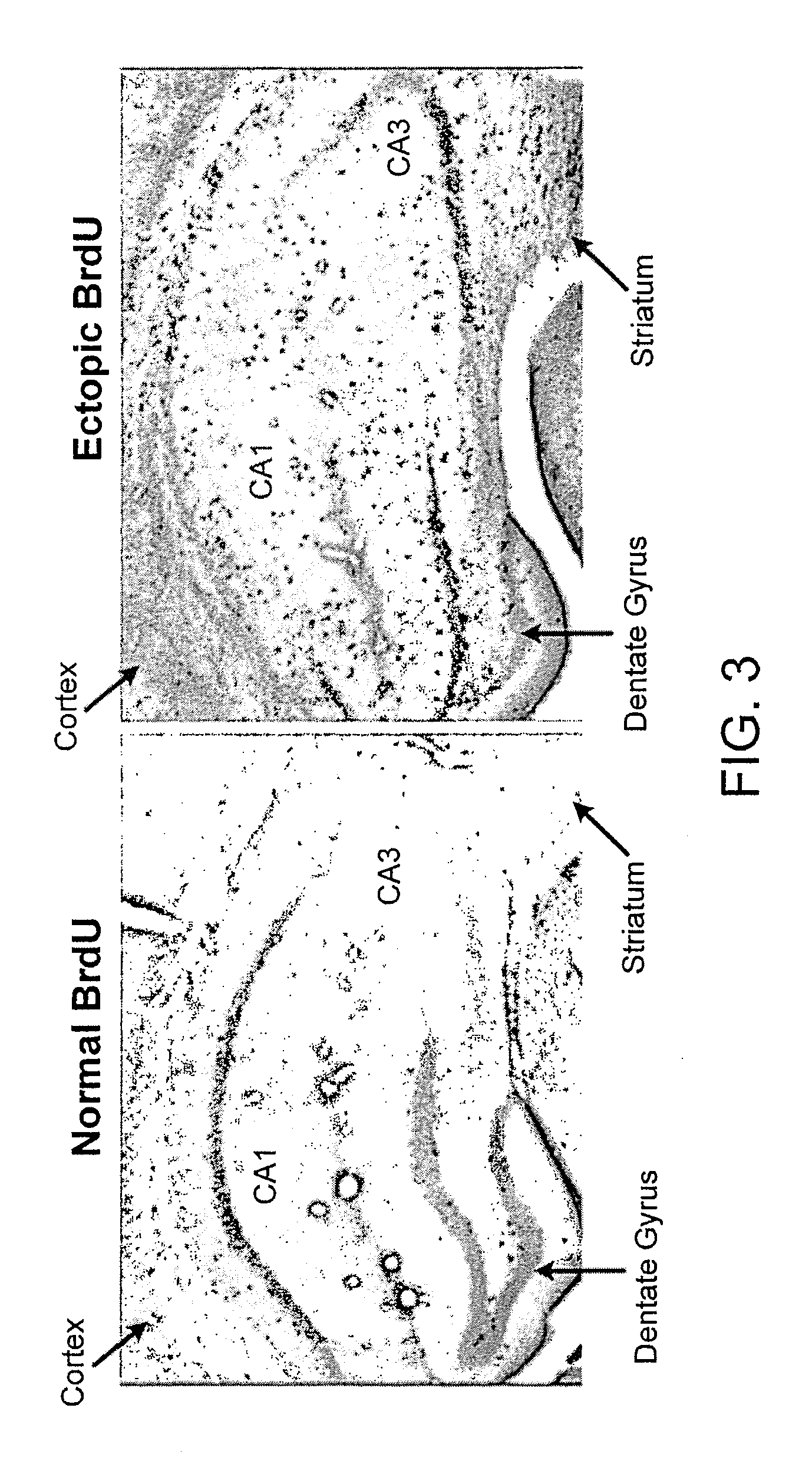 Methods of Treating Traumatic Brain Injury Using Pro-Neurogenic Compounds