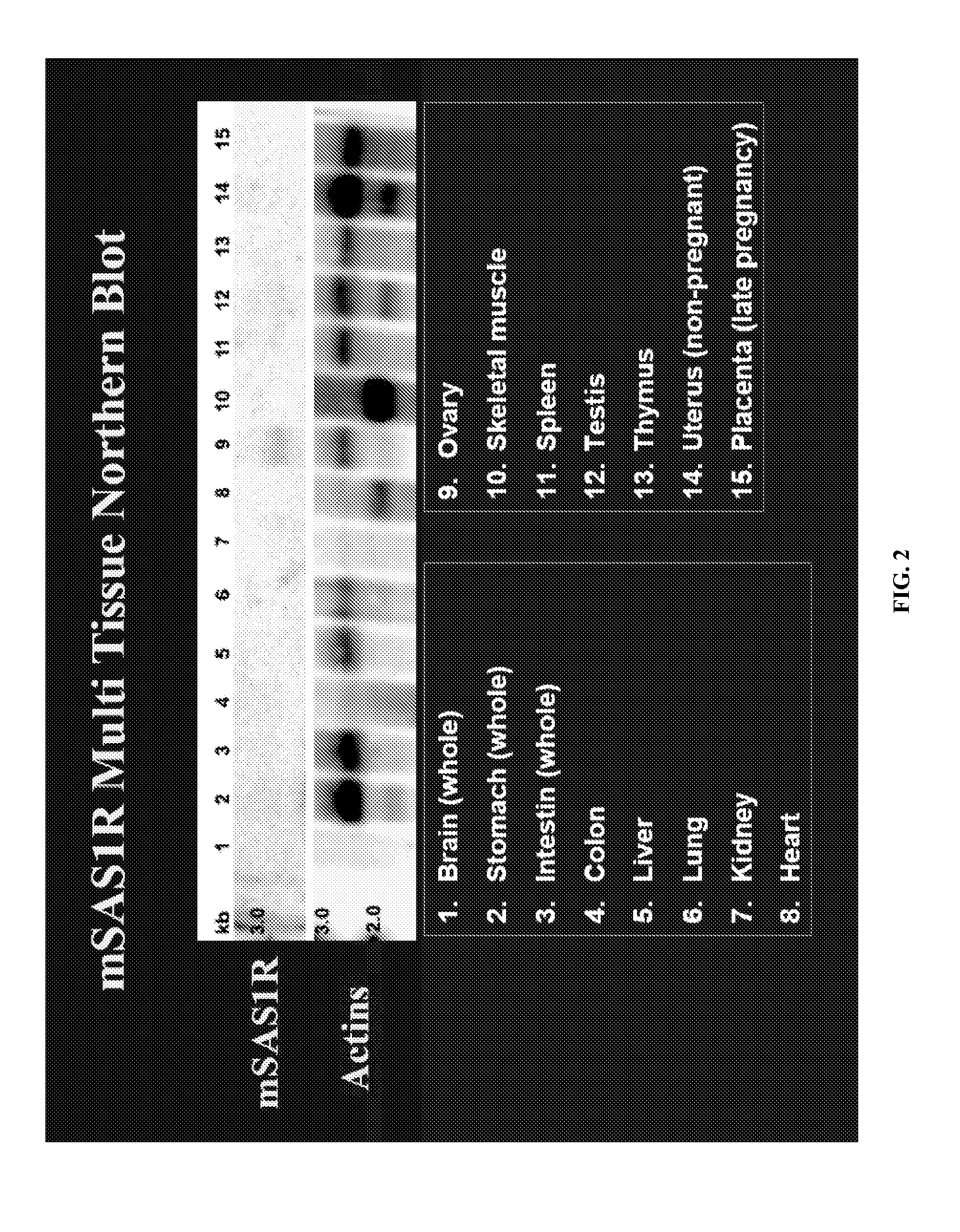 Compositions and methods for detecting, diagnosing, and treating cancer