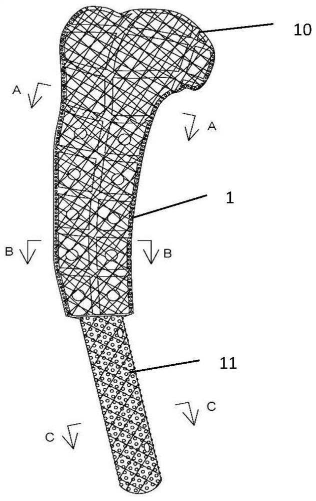 A frame type bone joint prosthesis and its preparation method and application