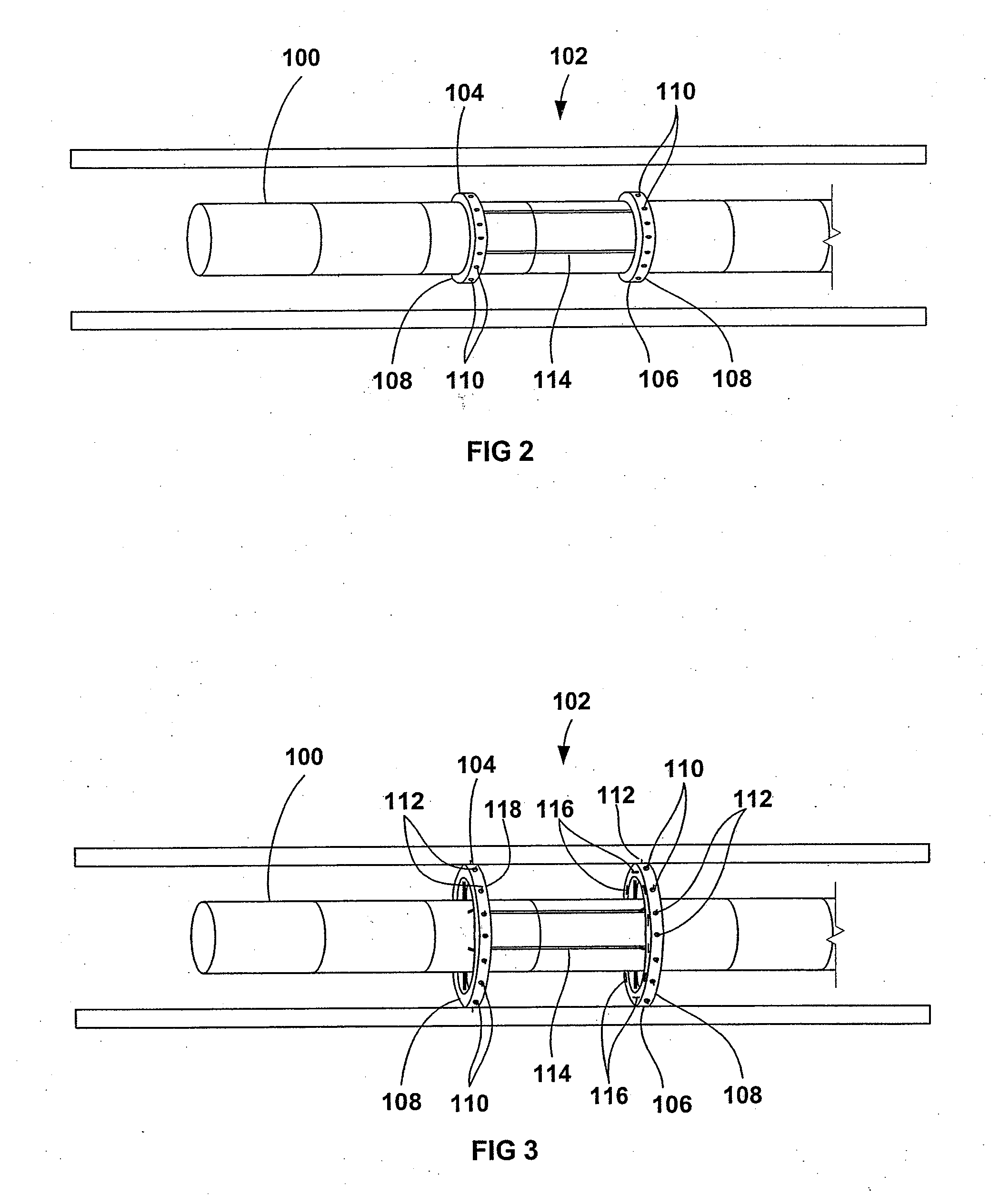 Apparatus and method for endoscopic colectomy