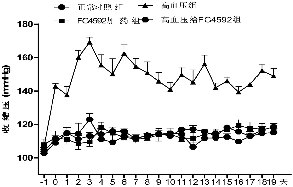 Application of FG4592 in the preparation of products for treatment of hypertension