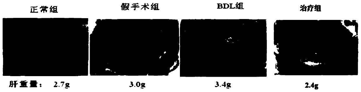 Benzoazacyclo compound and application thereof