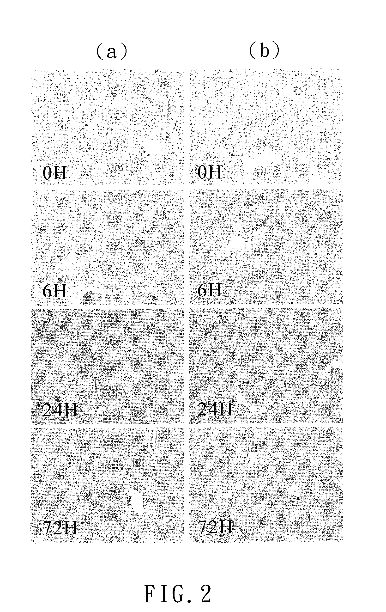 Therapy or prophylaxis of <i>Klebsiella pneumoniae </i>infections with a lytic bacteriophage specifically against the <i>K. pneumoniae</i>