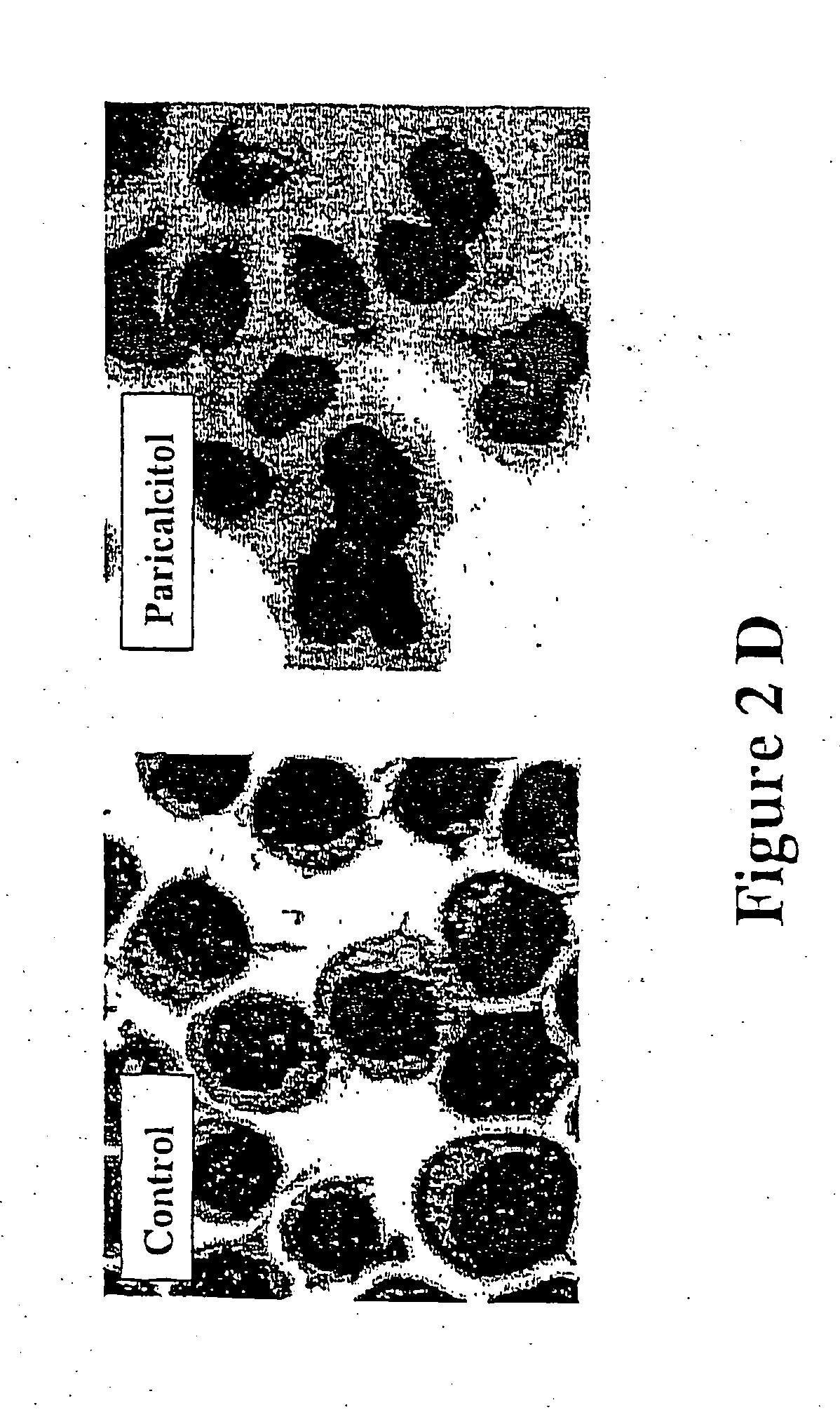 Paricalcitol as a chemotherapeutic agent