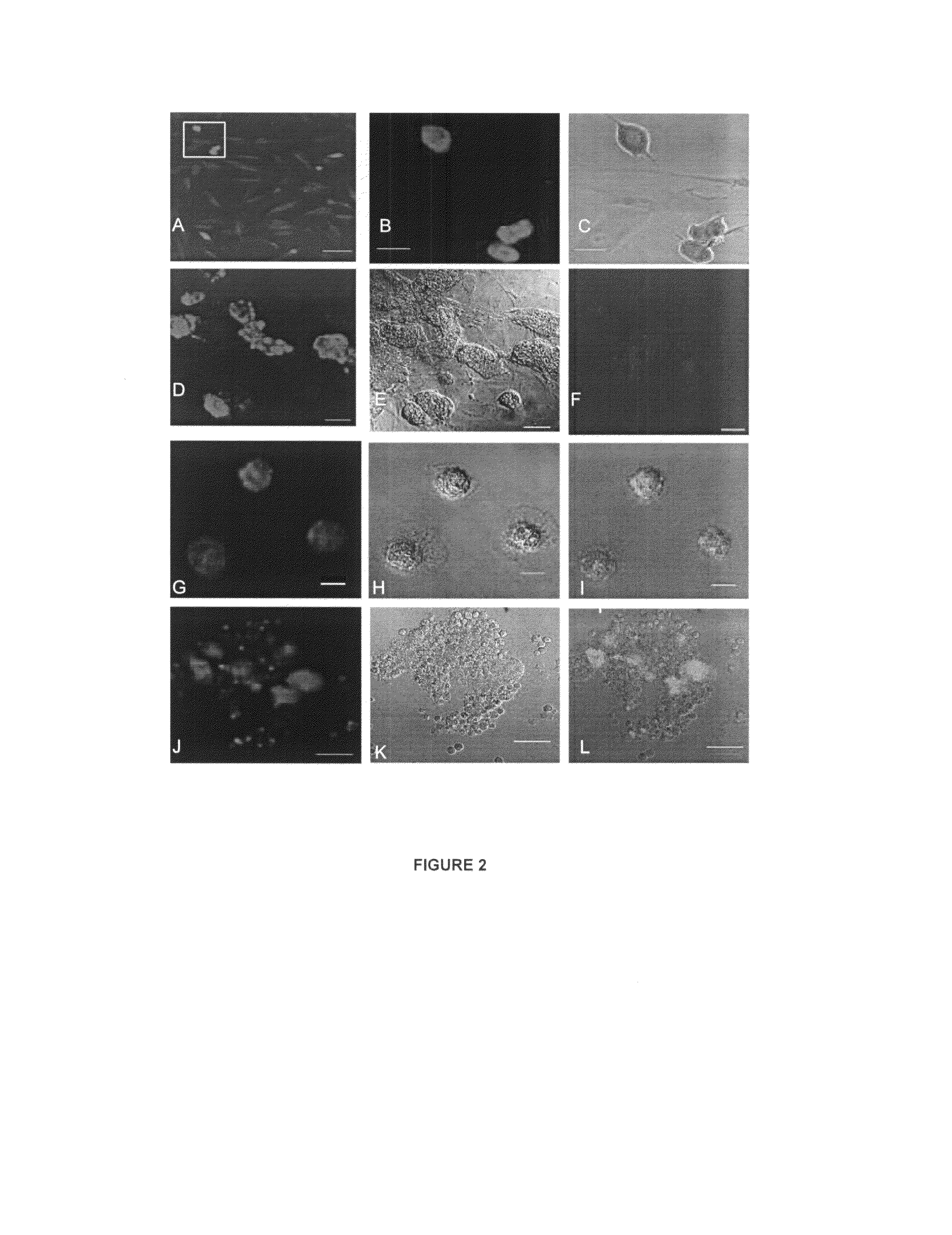 Methods, kits and compositions comprising crotamine