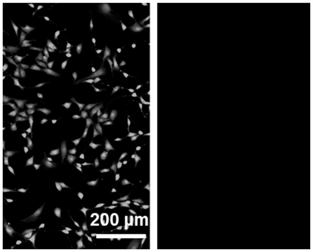 Antibacterial and antiviral degradable non-woven fabric as well as preparation method and application thereof