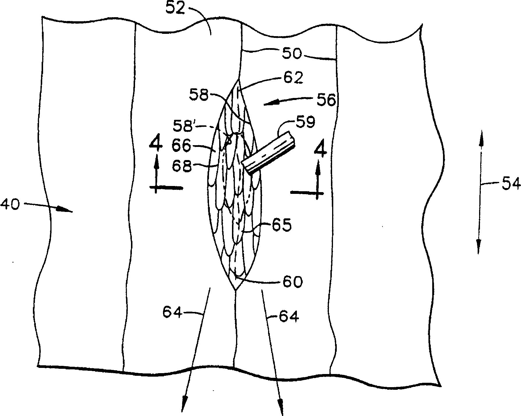 Weld repair of directionally solidified articles