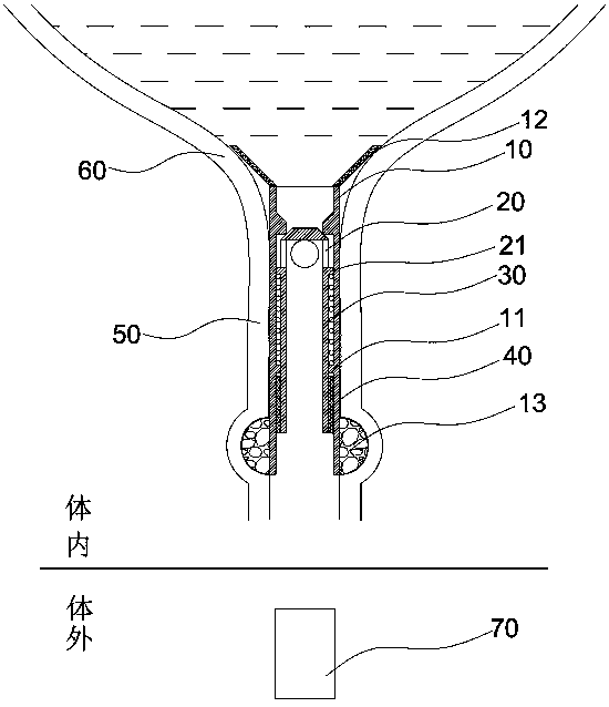 Magnetically controlled urethra valve