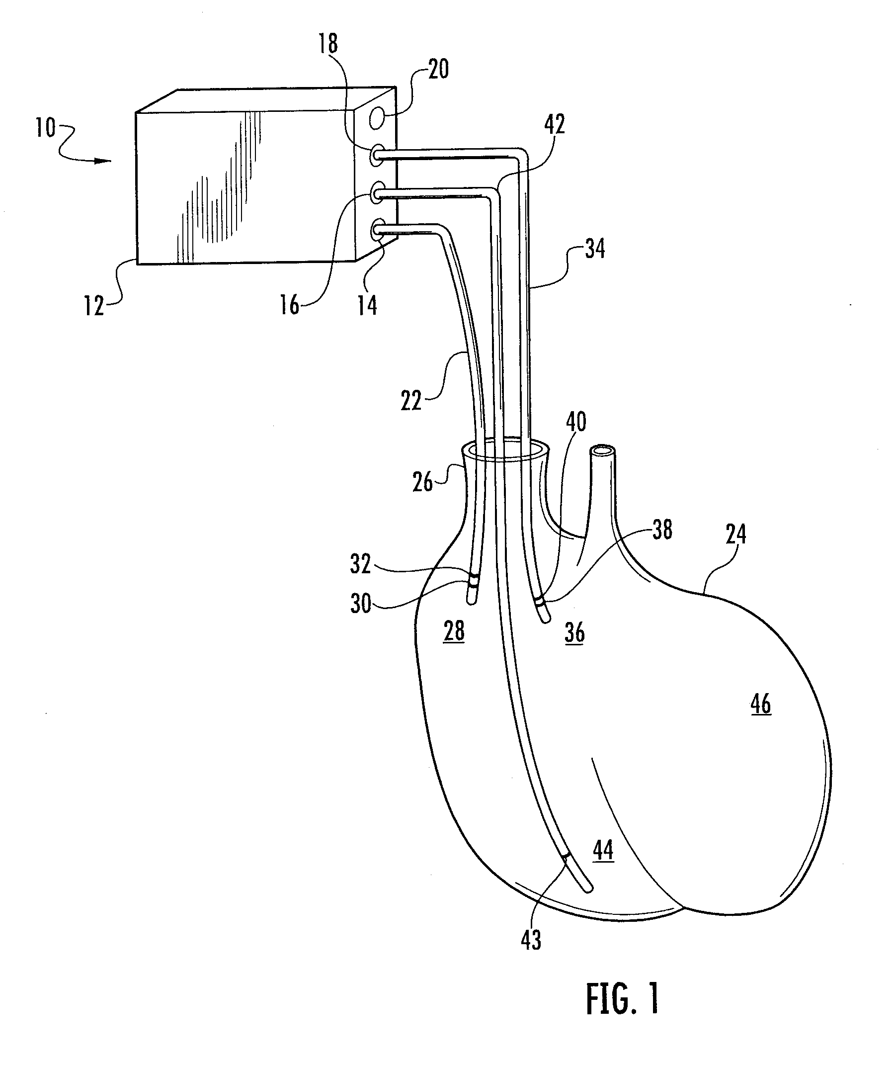 Device And Method For Peri-Hisian Pacing And/Or Simultaneous Bi-Ventricular or Tri-Ventricular Pacing For Cardiac Resynchronization