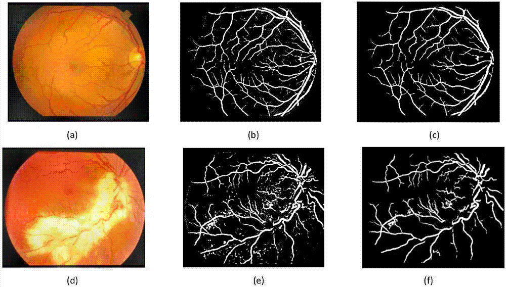 Multi-characteristic fusion monitored retinal blood vessel extraction method