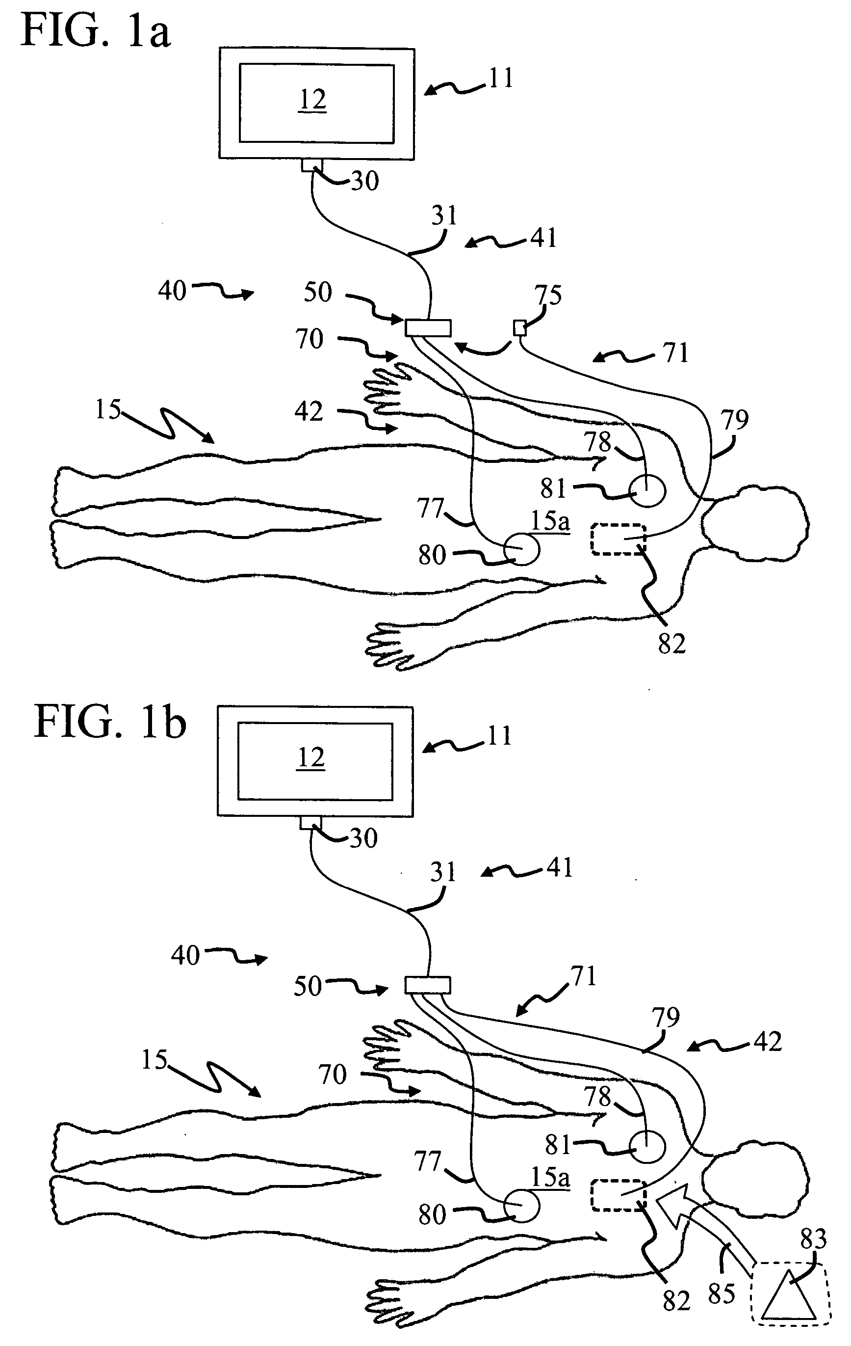 Electrode system for a physiological stimulator