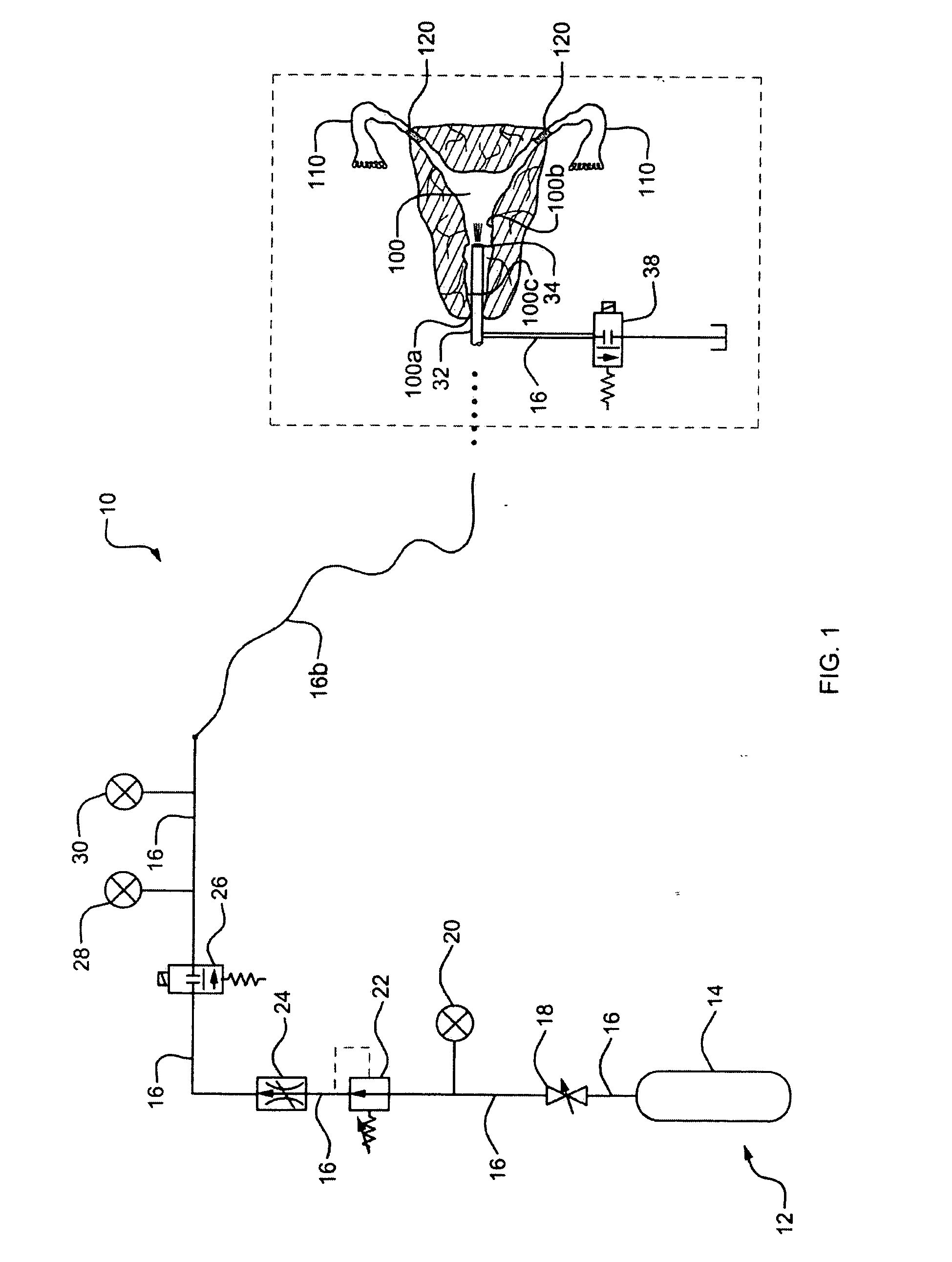 Method and apparatus for verifying occlusion of fallopian tubes