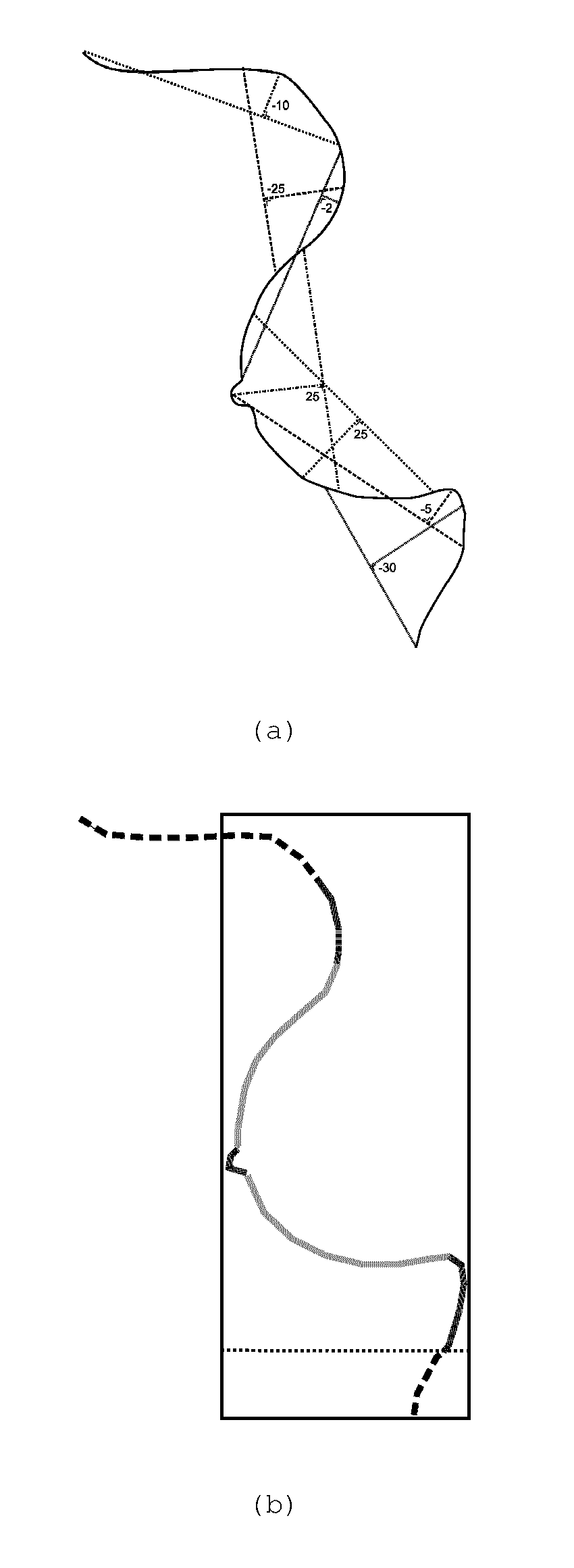 Method for defining a region of interest in a radiation image of a breast