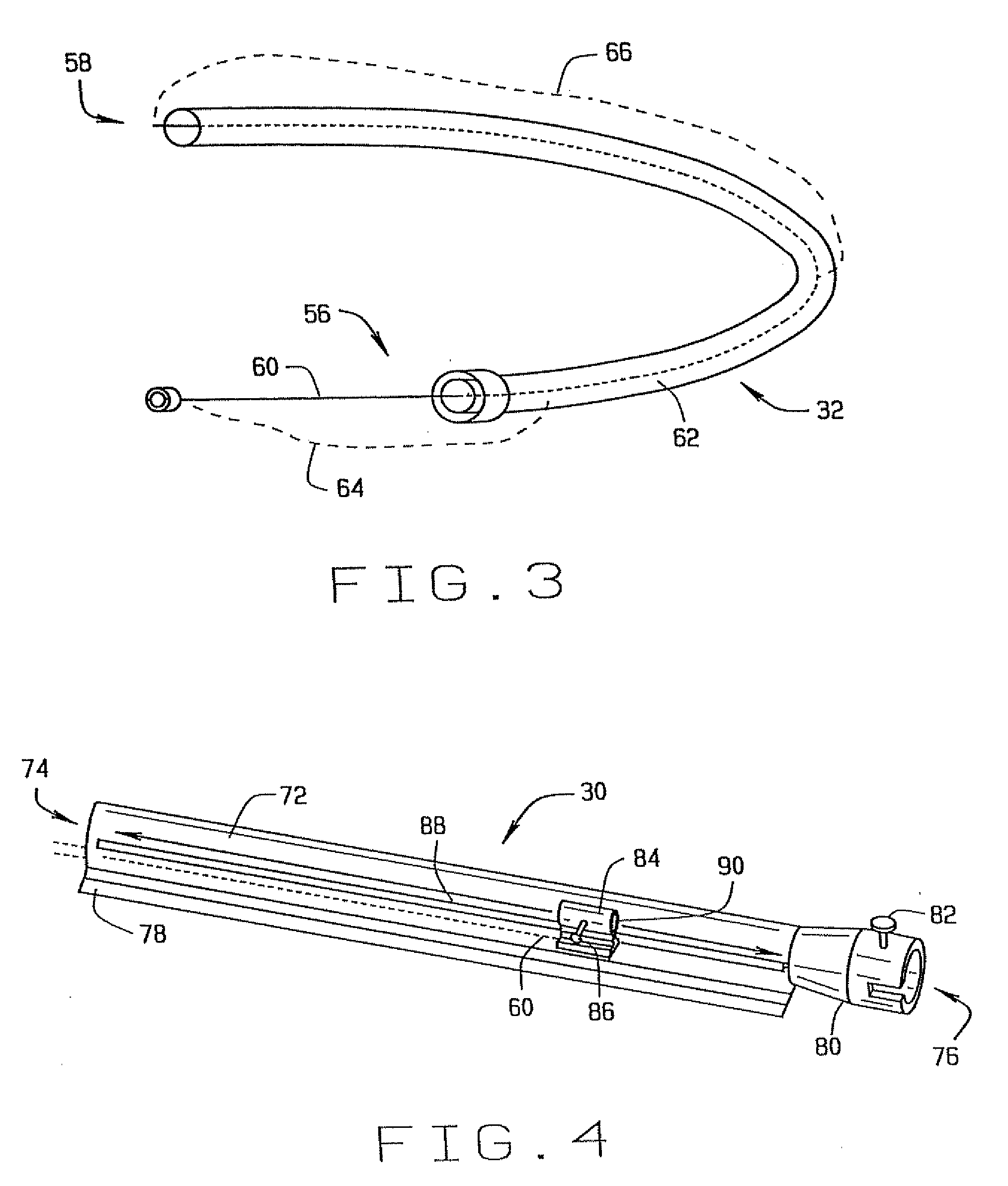 System and Methods for Advancing a Catheter