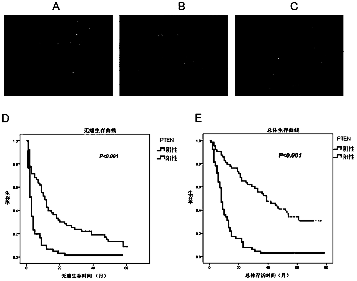 Combination of proteasome inhibitors and autophagy activators in the treatment of cholangiocarcinoma