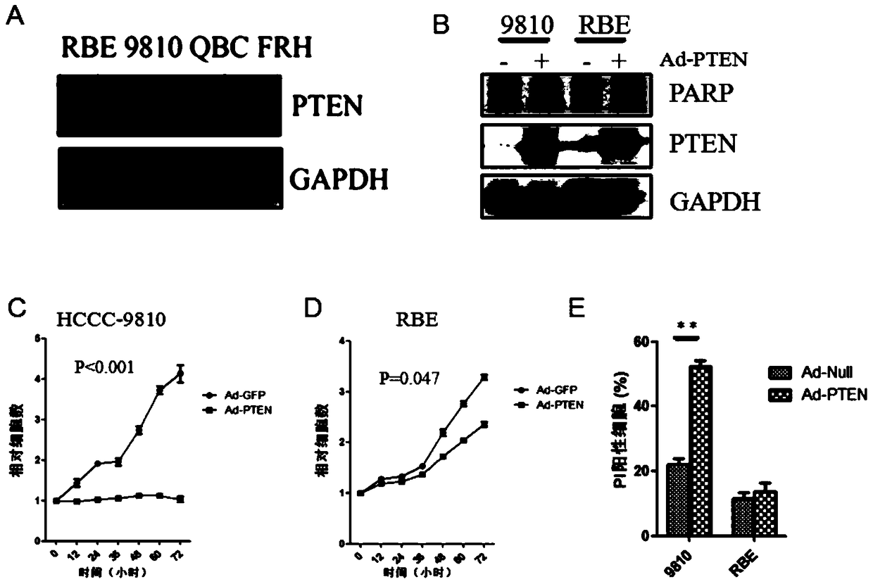 Combination of proteasome inhibitors and autophagy activators in the treatment of cholangiocarcinoma