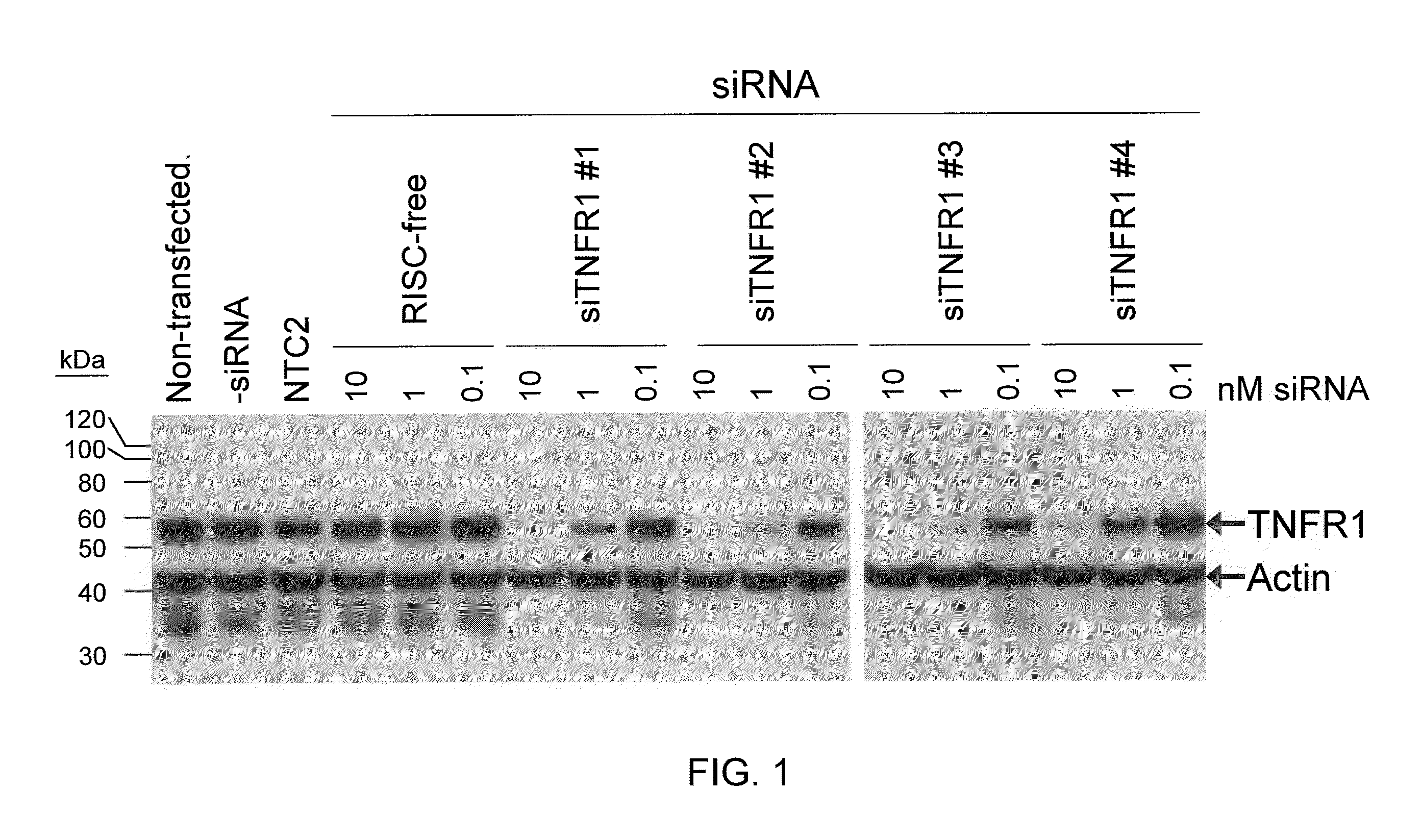 RNAi-RELATED INHIBITION OF TNFa SIGNALING PATHWAY FOR TREATMENT OF GLAUCOMA