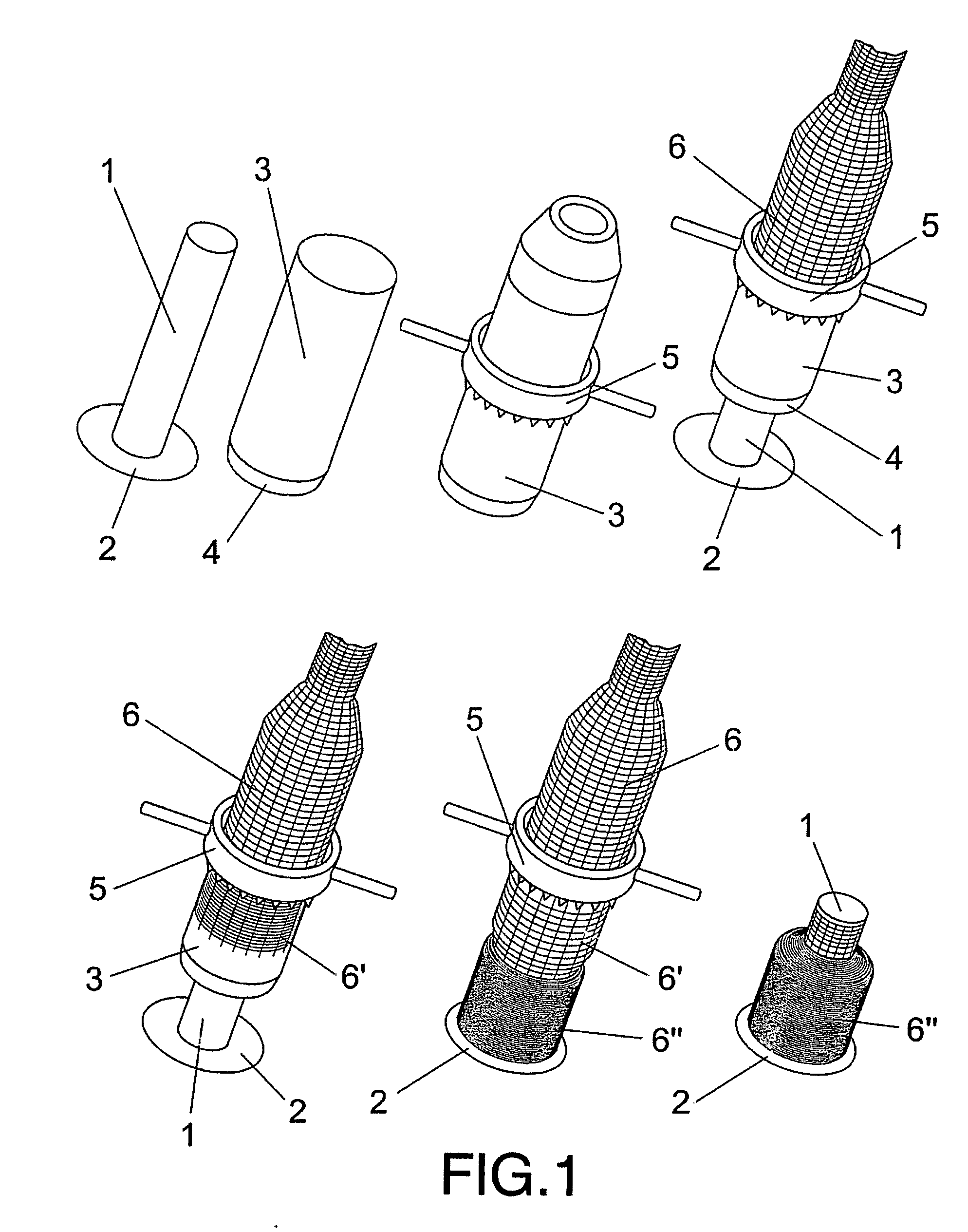 Multi-layer arrangement of a tubular net on a support tube, and device and method for obtaining same
