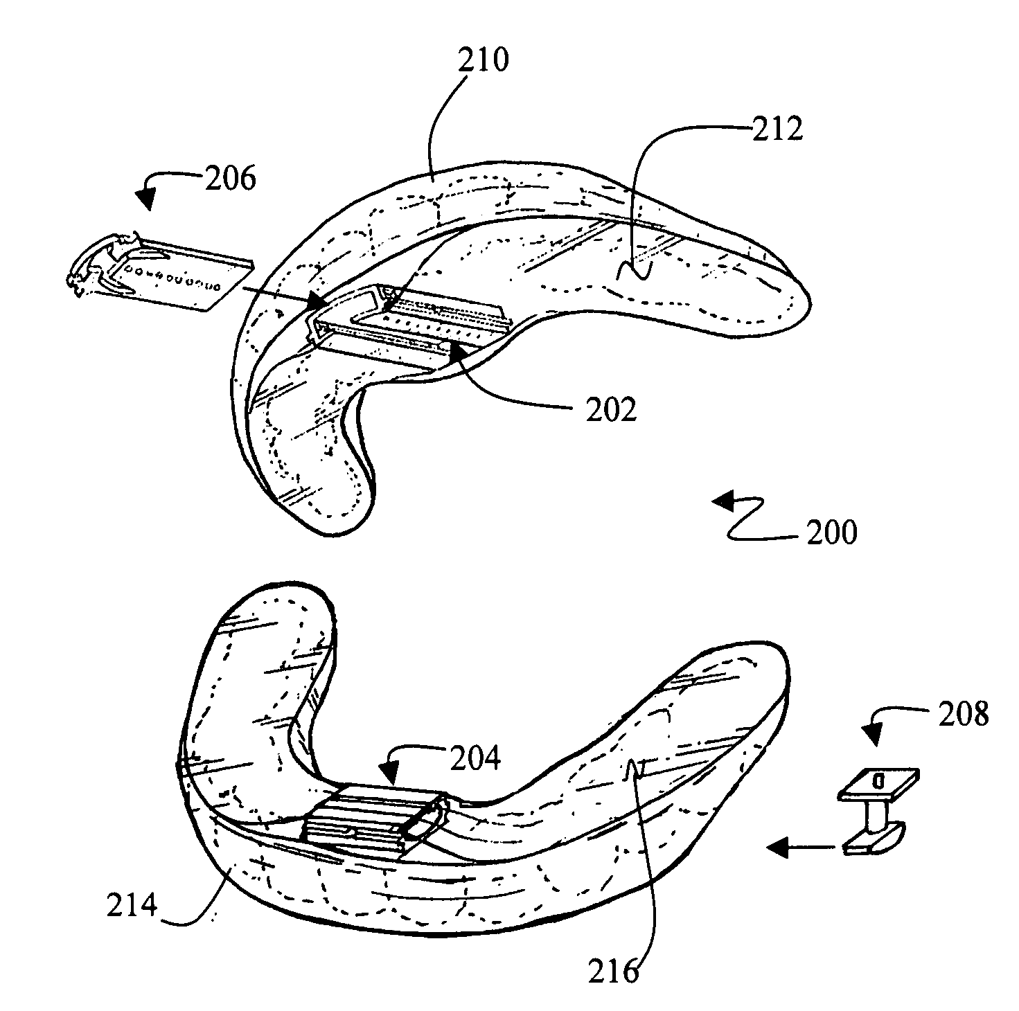 Apparatus and method for caring for obstructive sleep disorder breathing