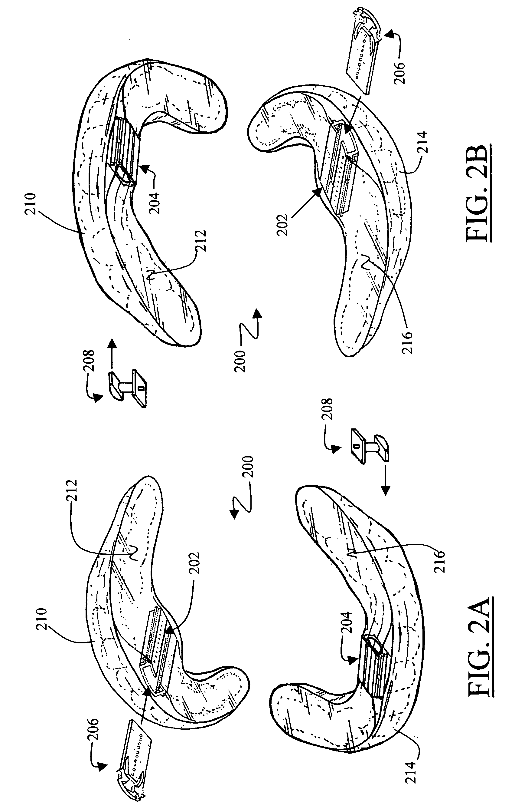Apparatus and method for caring for obstructive sleep disorder breathing