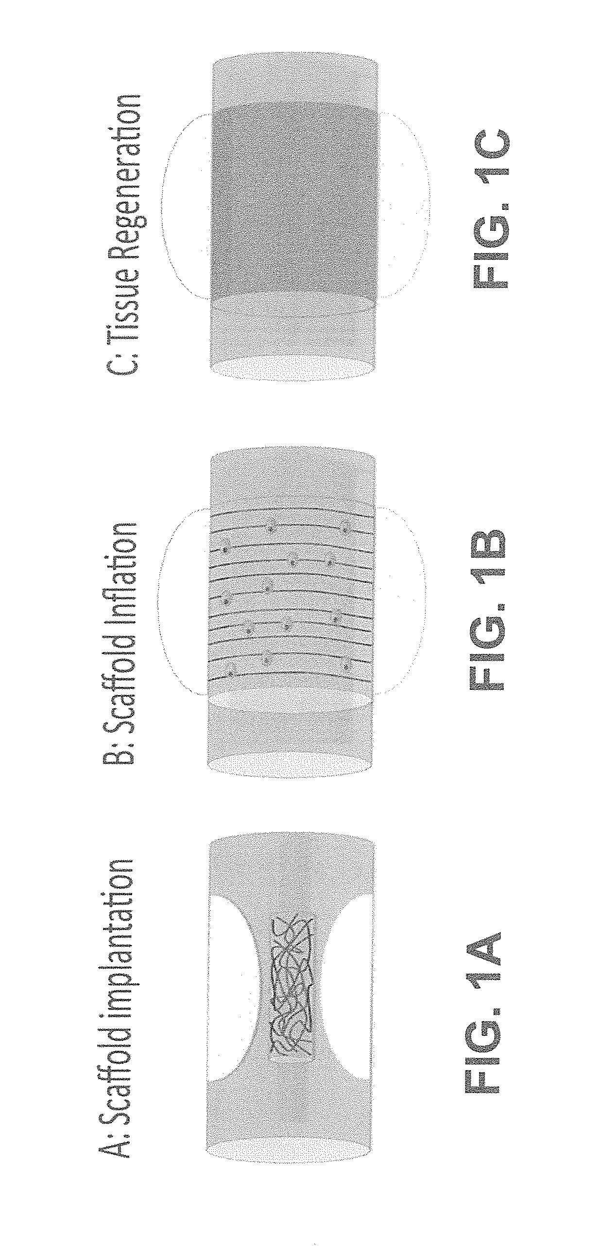 Fibrous tubular conduit for stenting applications