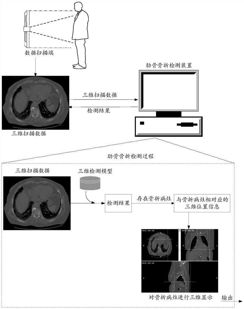 Rib fracture detection method and rib fracture detection information display method and system