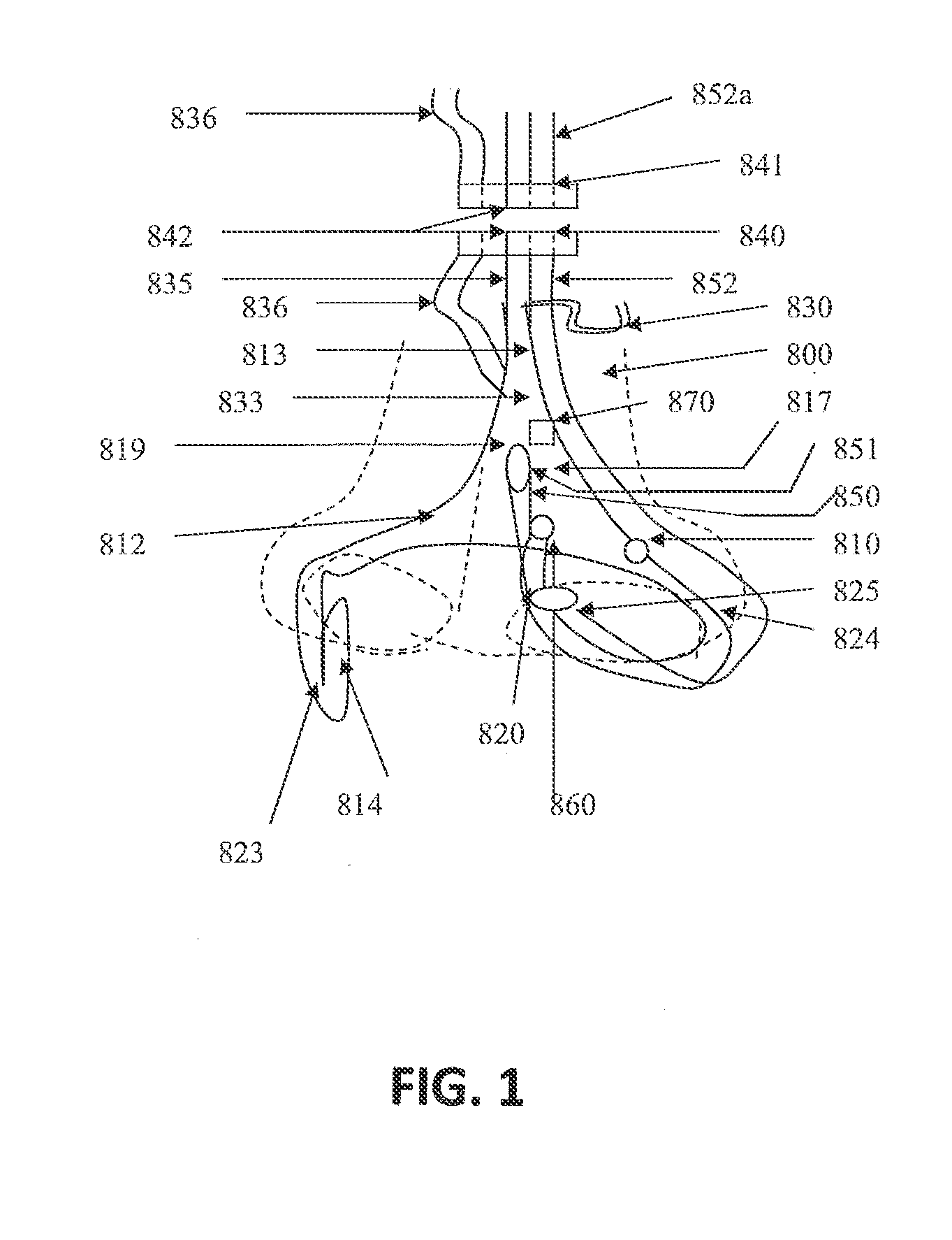 Systems And Methods For Using Photoplethysmography In The Administration Of Narcotic Reversal Agents