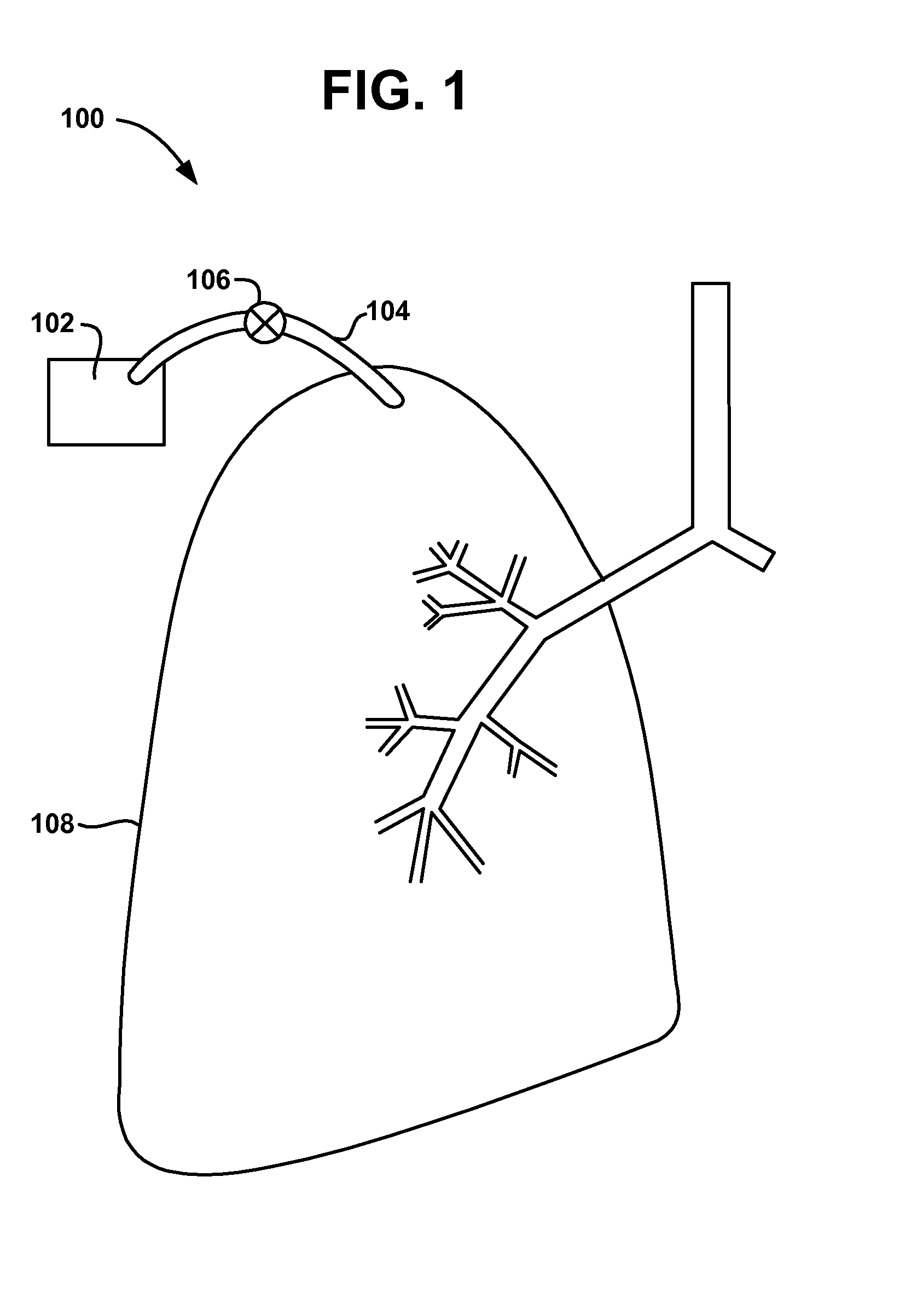 Methods and devices to create a chemically and/or mechanically localized pleurodesis