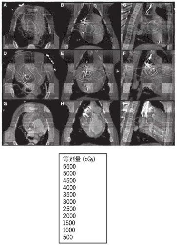 System and method for carbon particle therapy for treatment of cardiac arrhythmias and other diseases