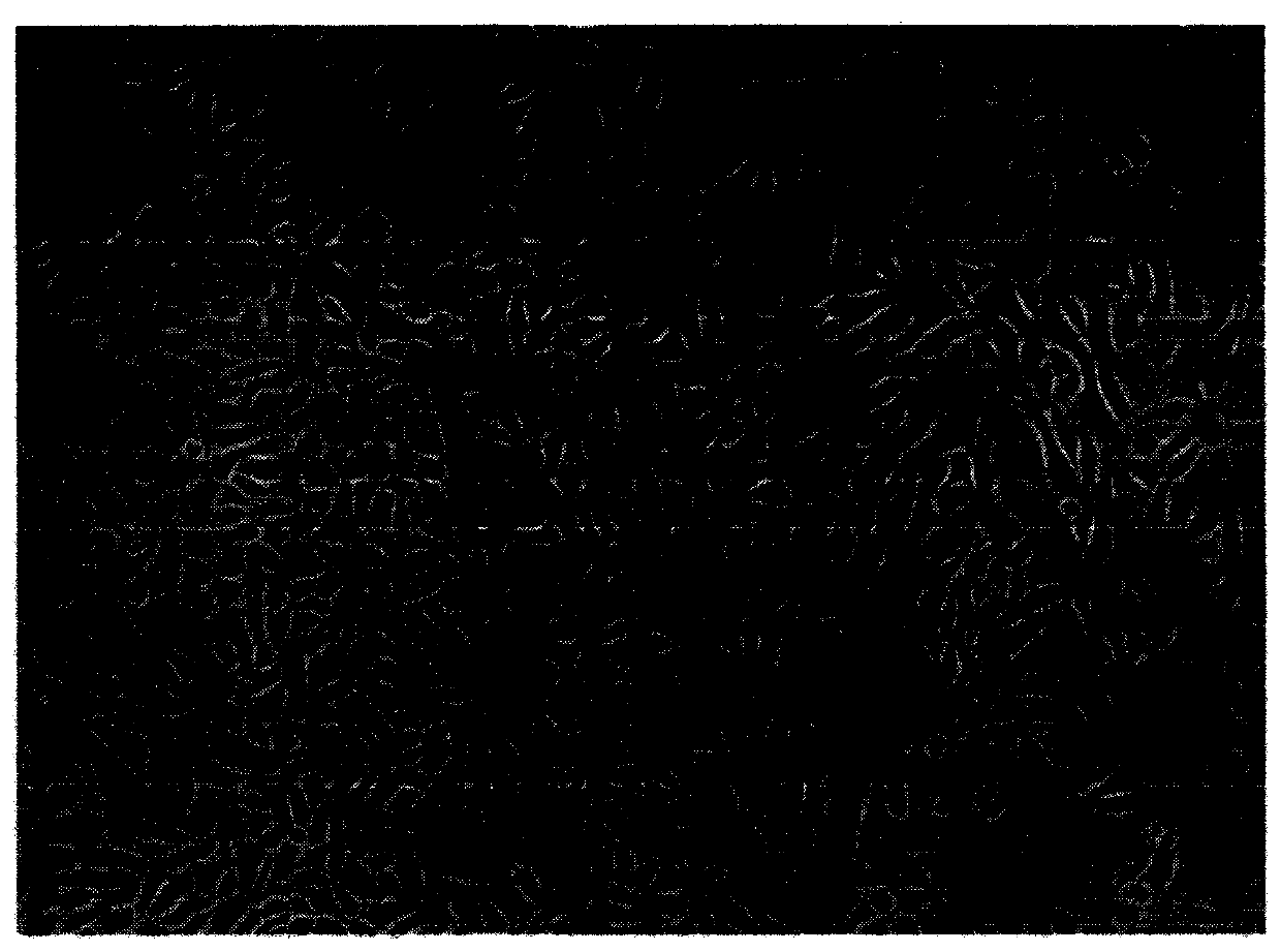 Cell culture composition and use for primary culture of tumor cells